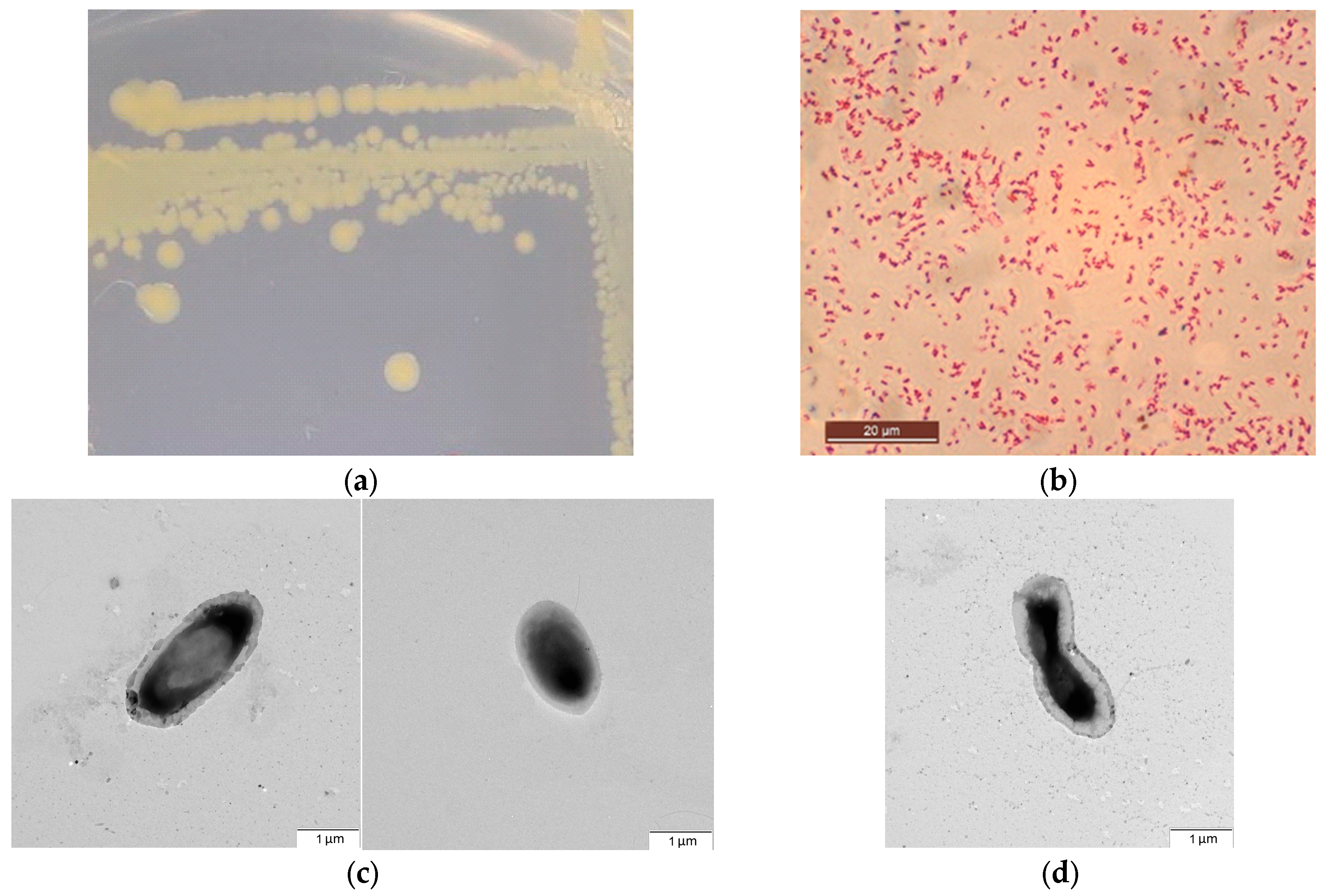 Microorganisms 13 00474 g003