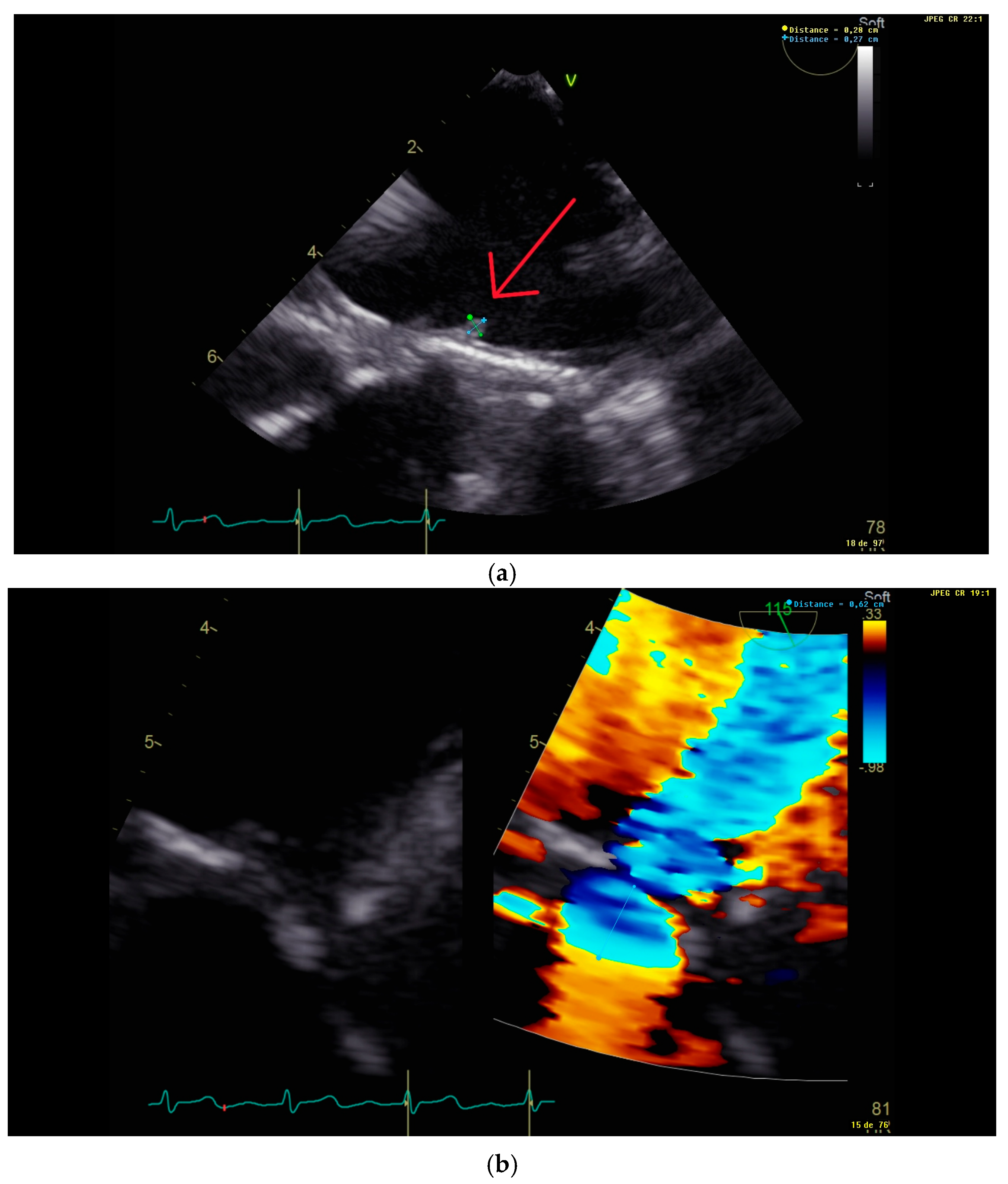 Microorganisms 13 00580 g002