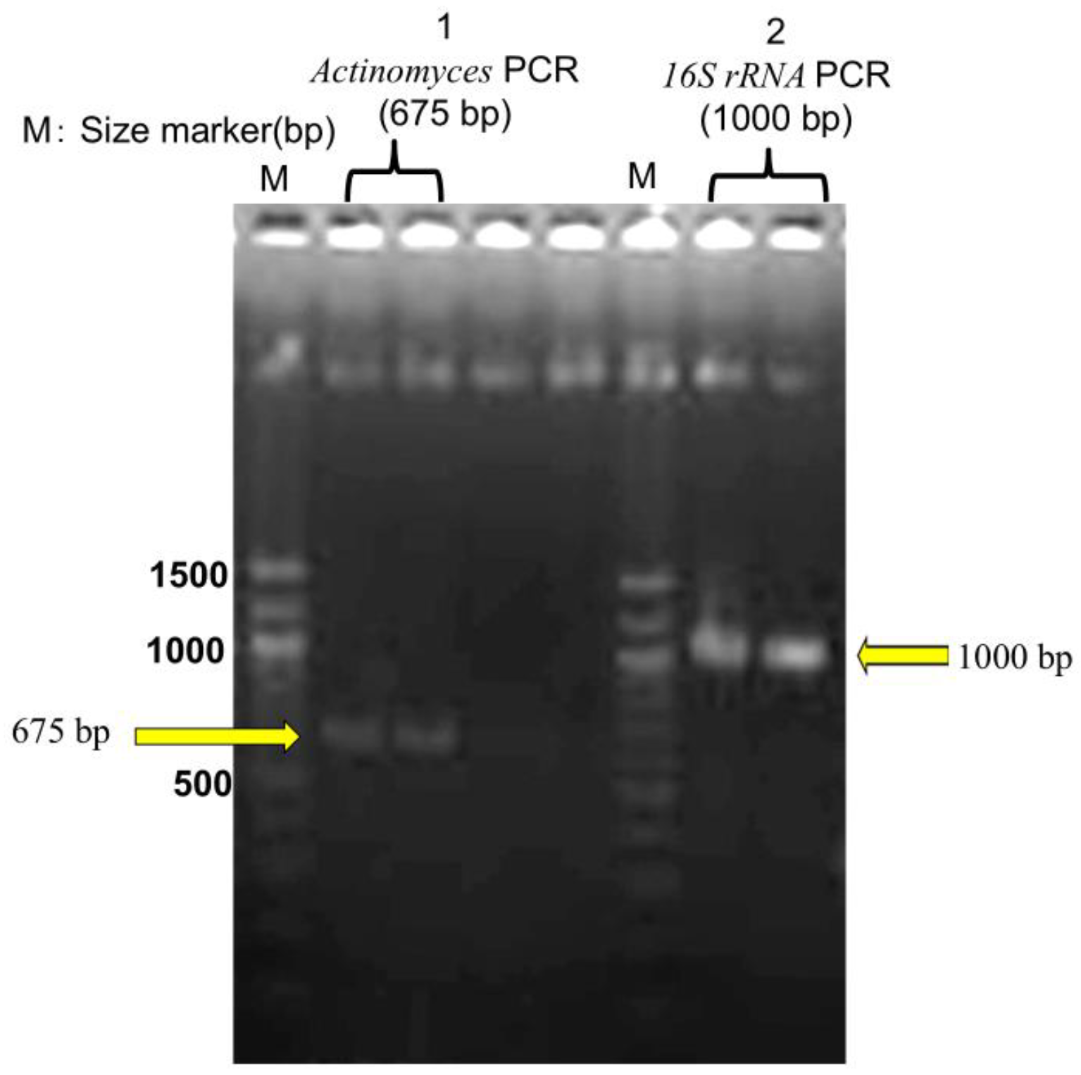 Microorganisms 13 00671 g005