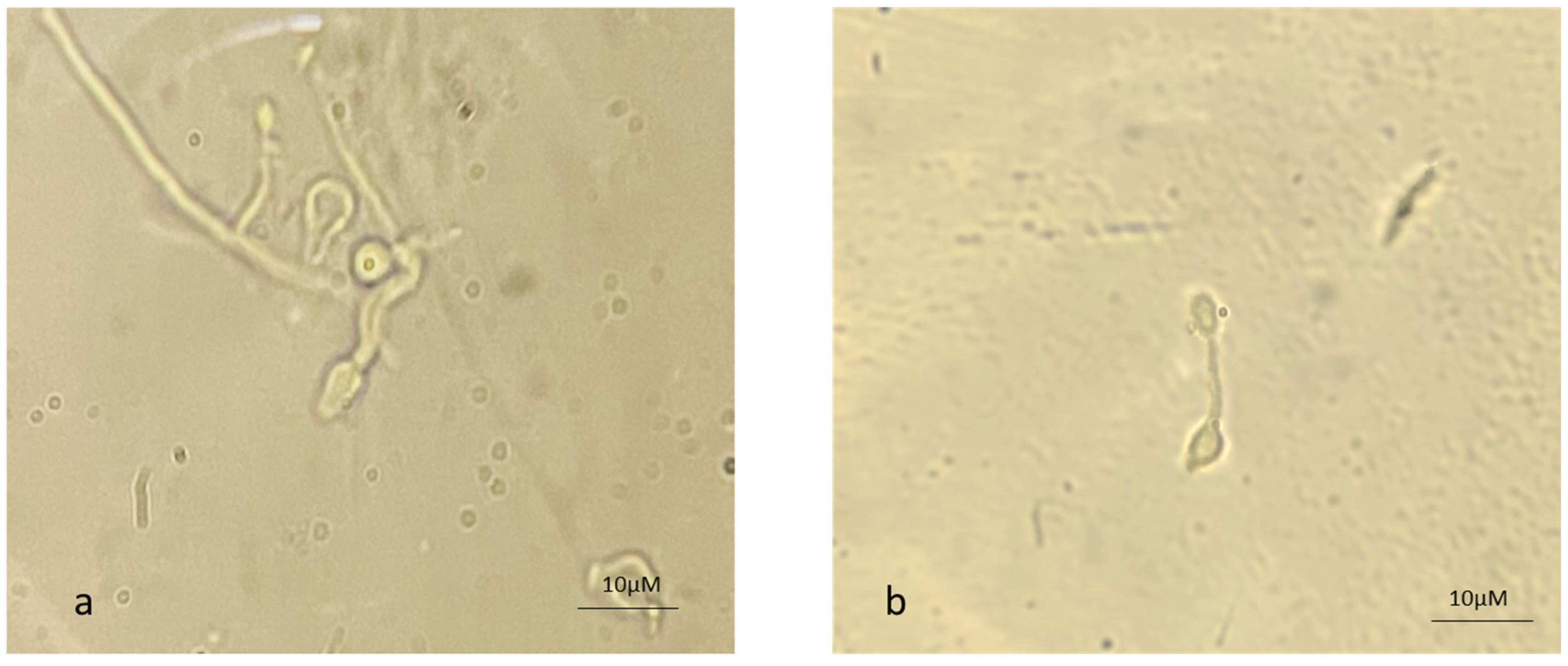 Microorganisms 13 00900 g004