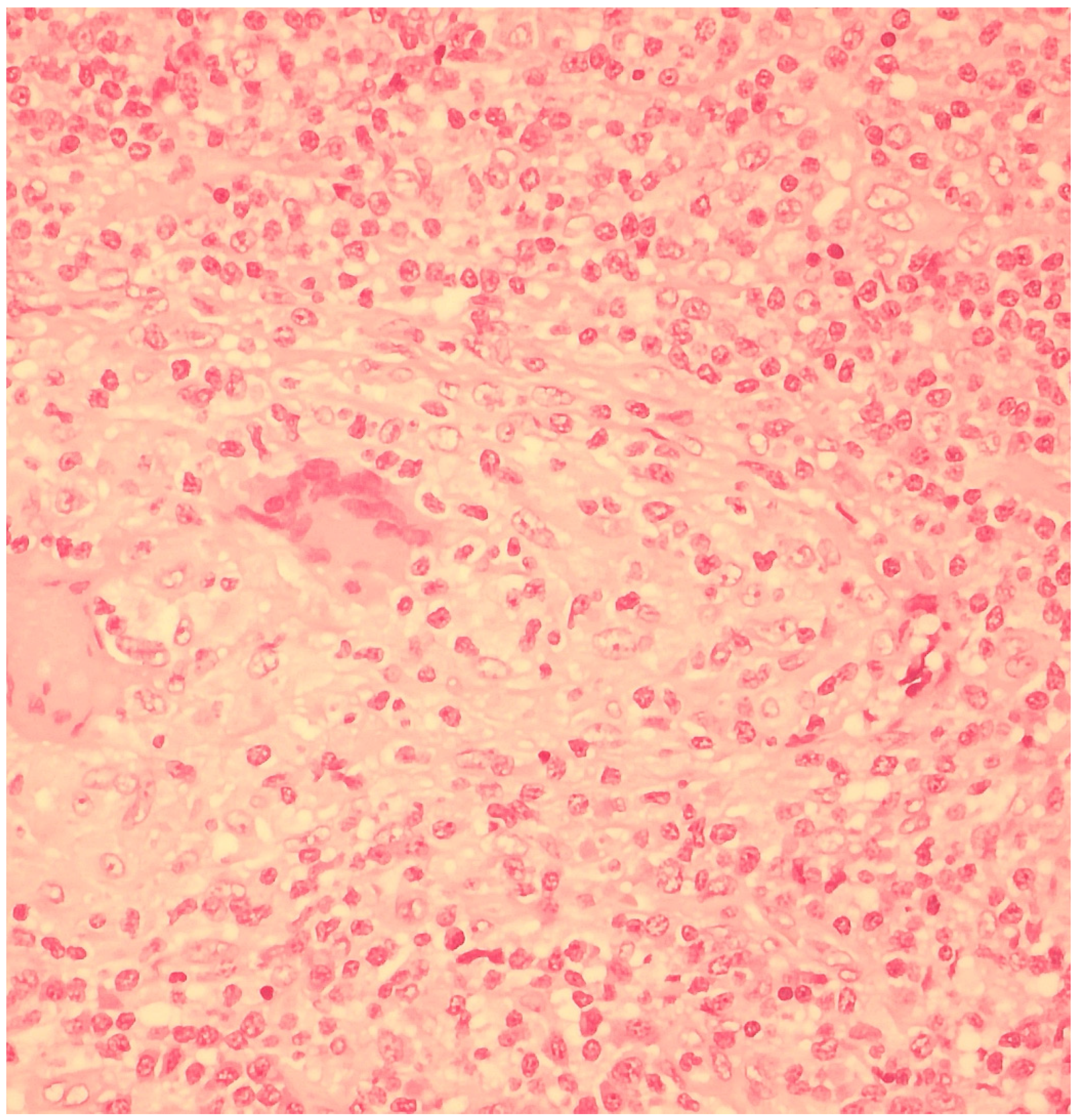 Microorganisms 13 00968 g002