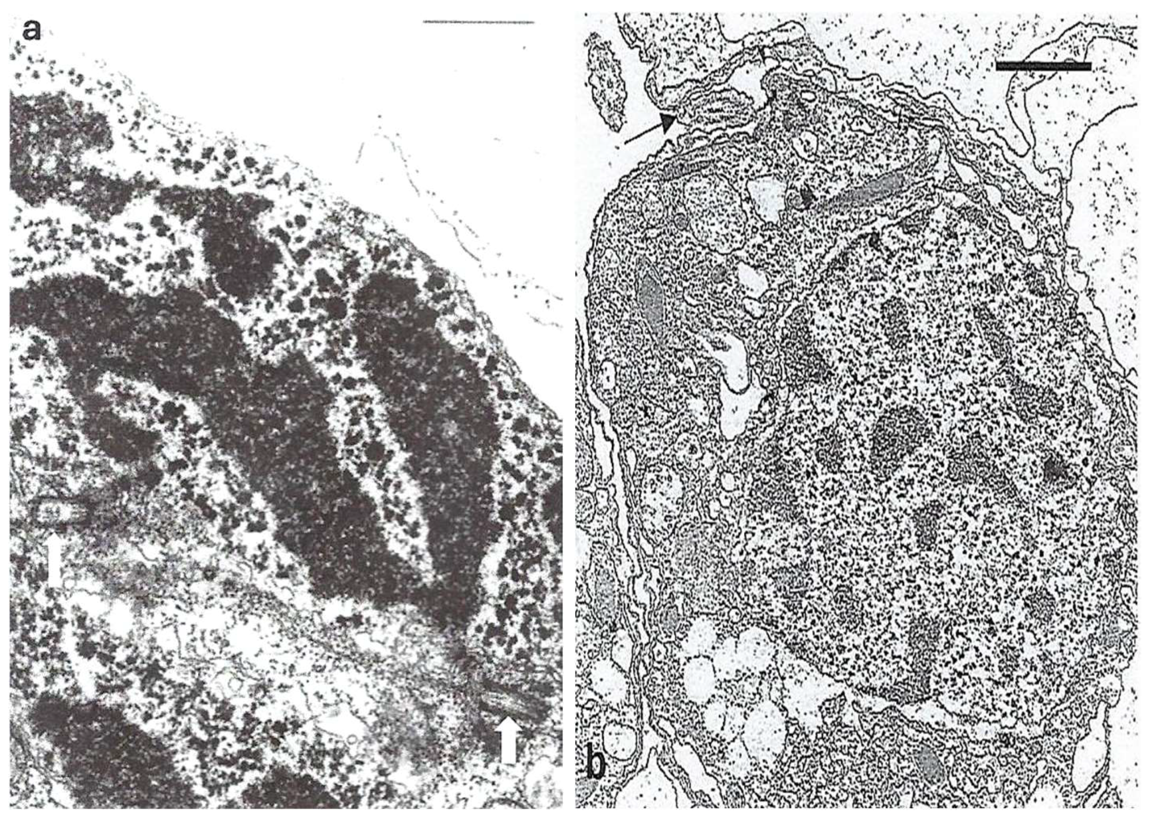 Microorganisms 13 00969 g017