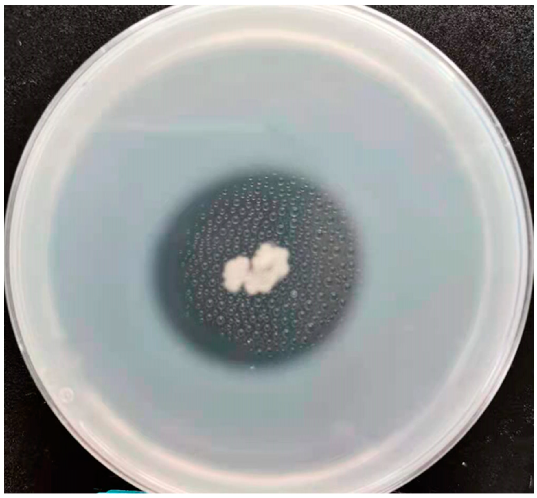 Microorganisms 13 00993 g005