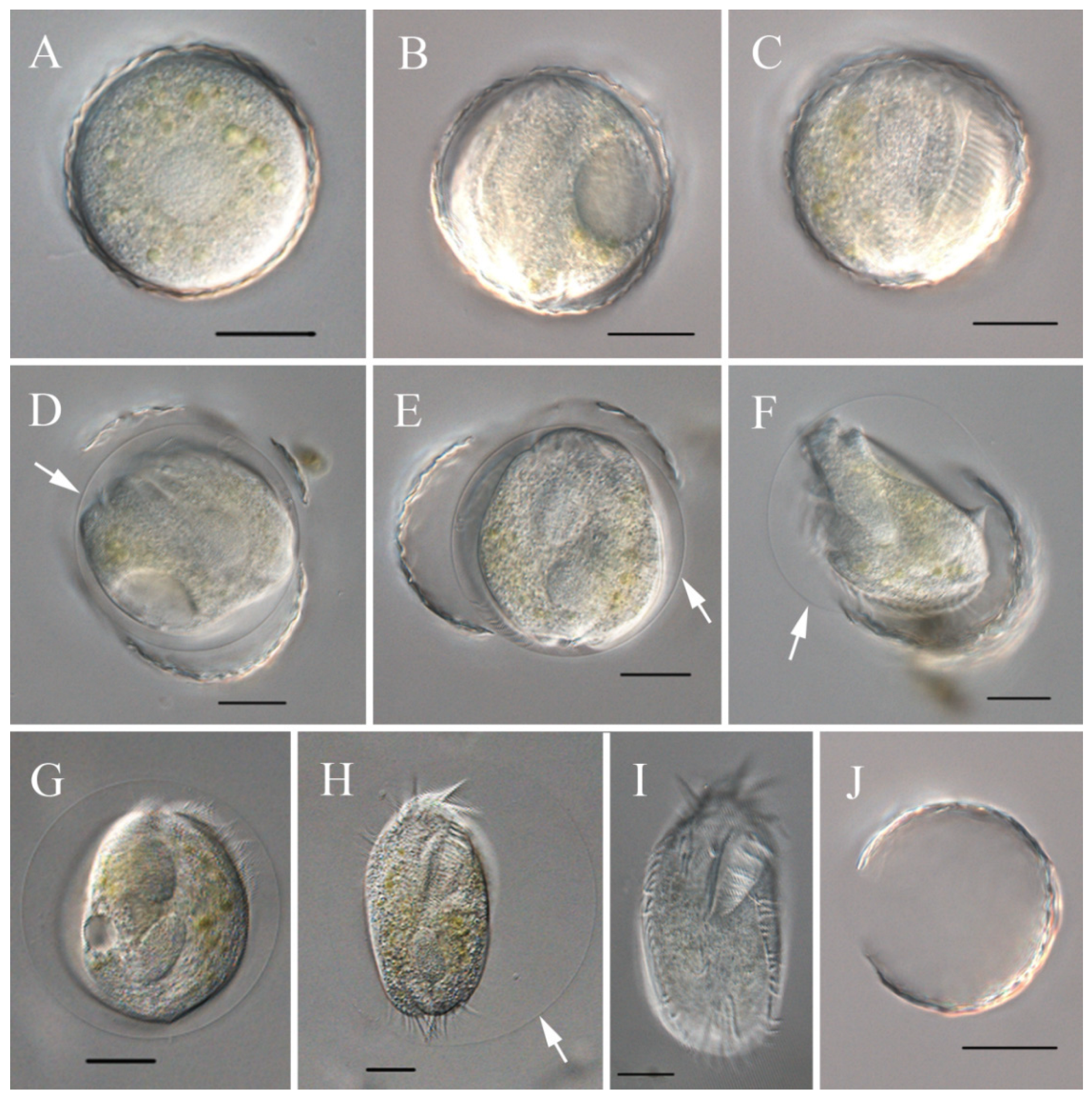 Microorganisms 13 01016 g006