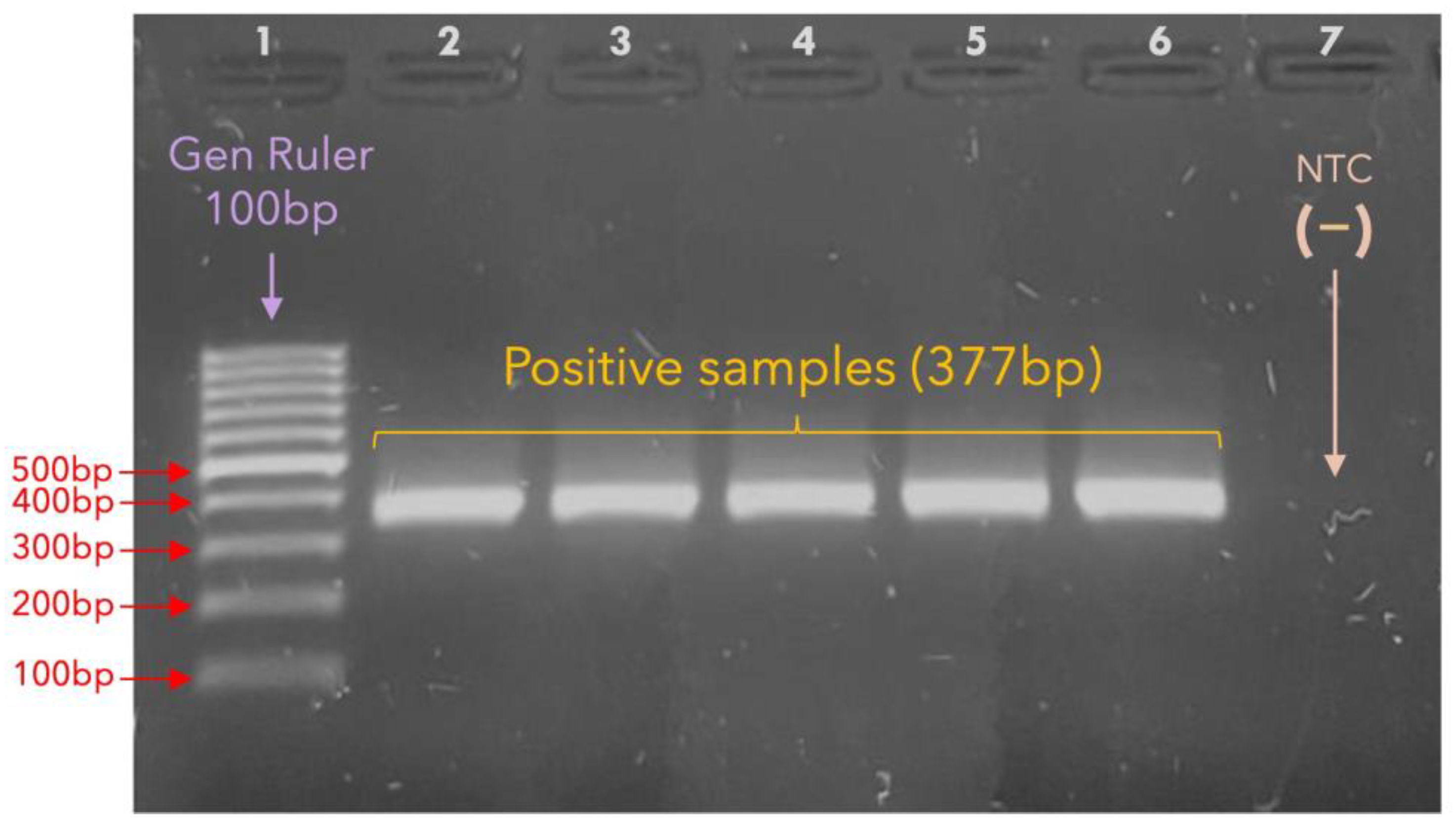 Microorganisms 13 01069 g002