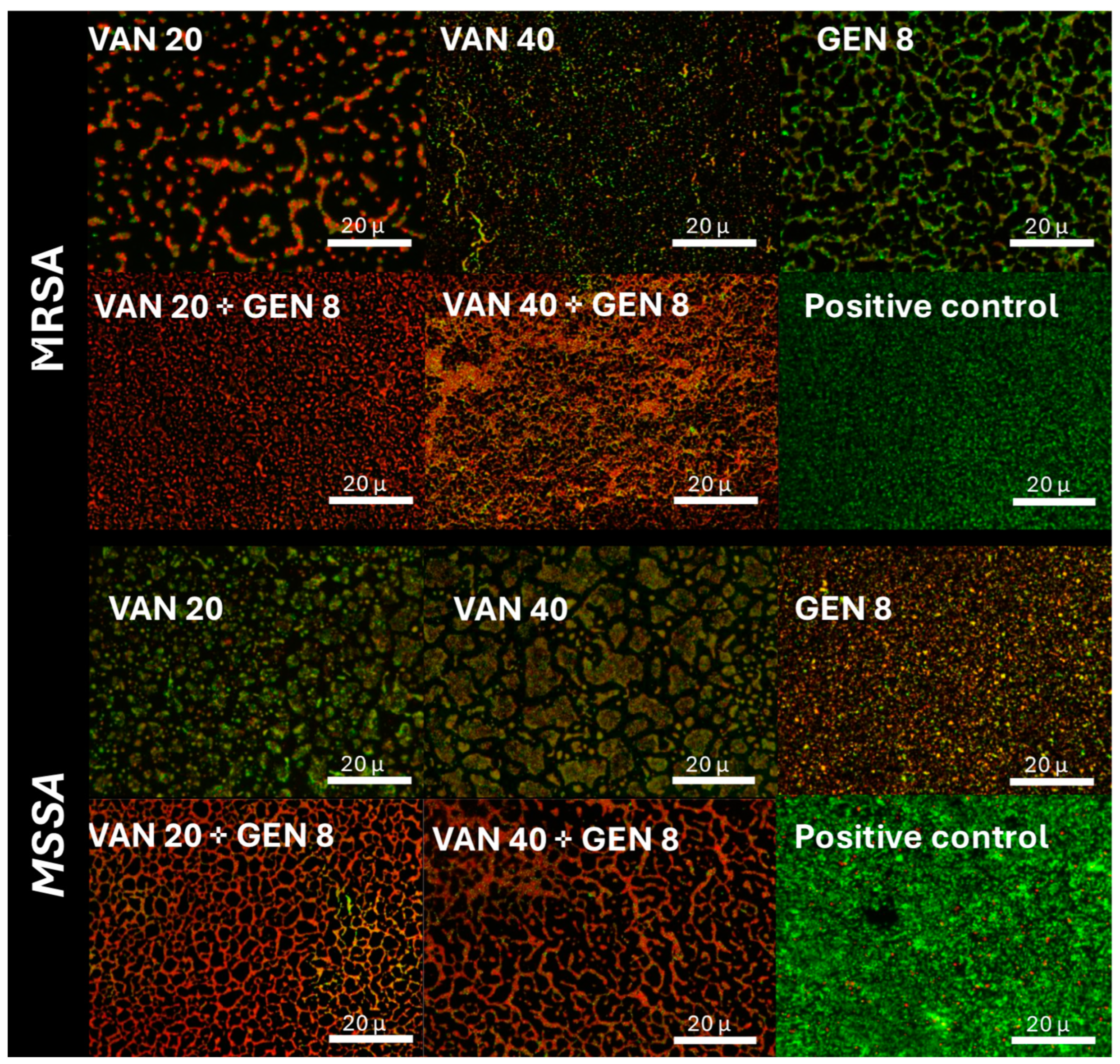 Microorganisms 13 01119 g003