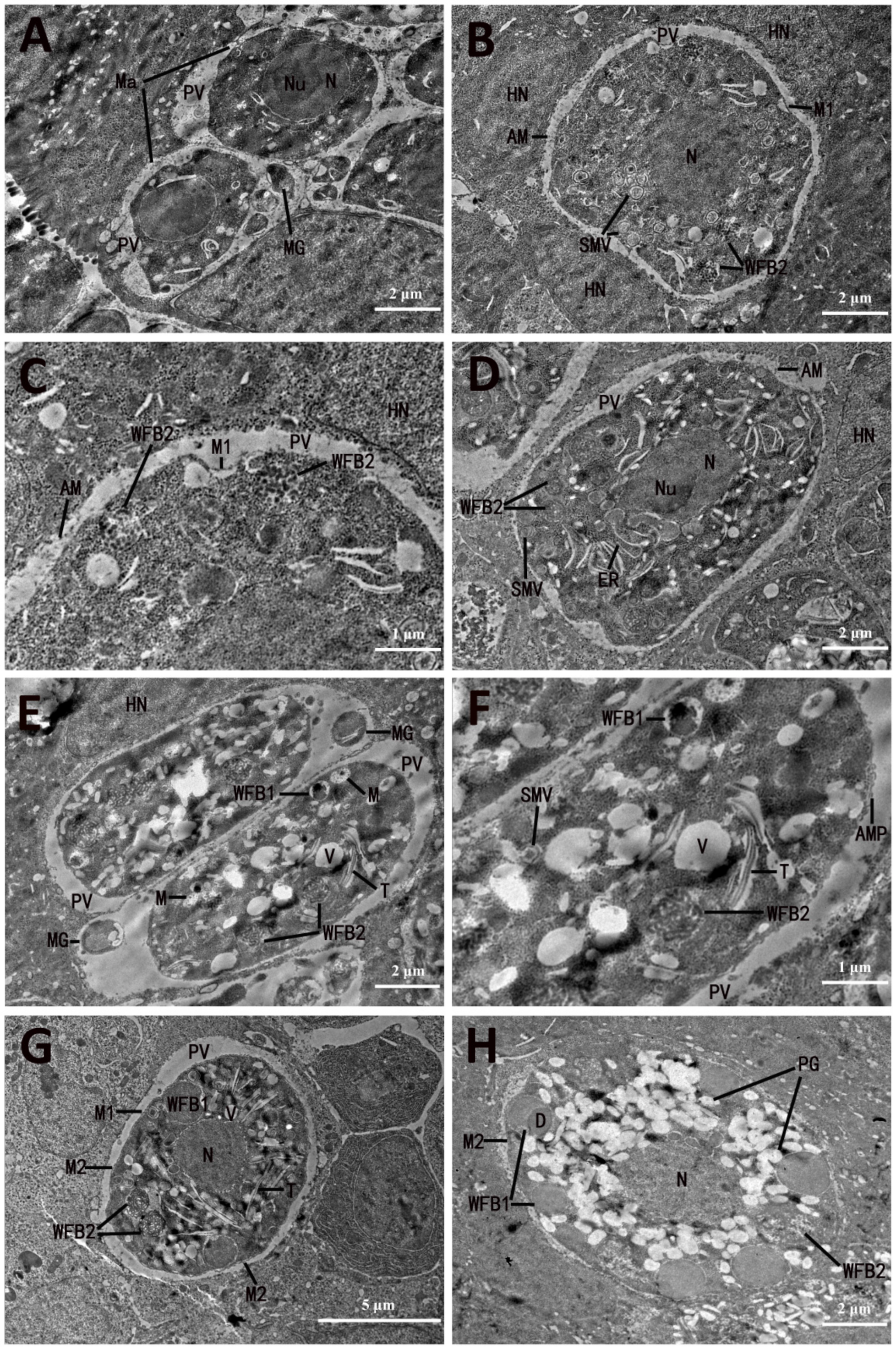 Microorganisms 13 01135 g003