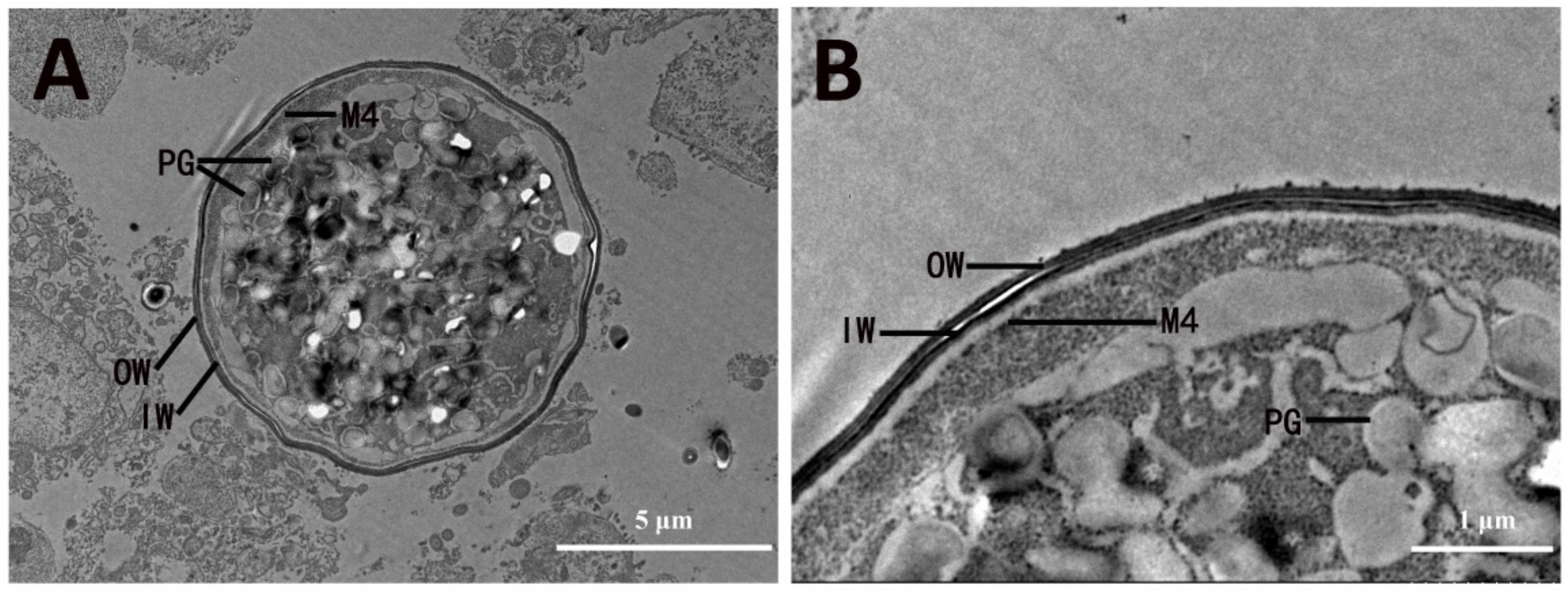 Microorganisms 13 01135 g005