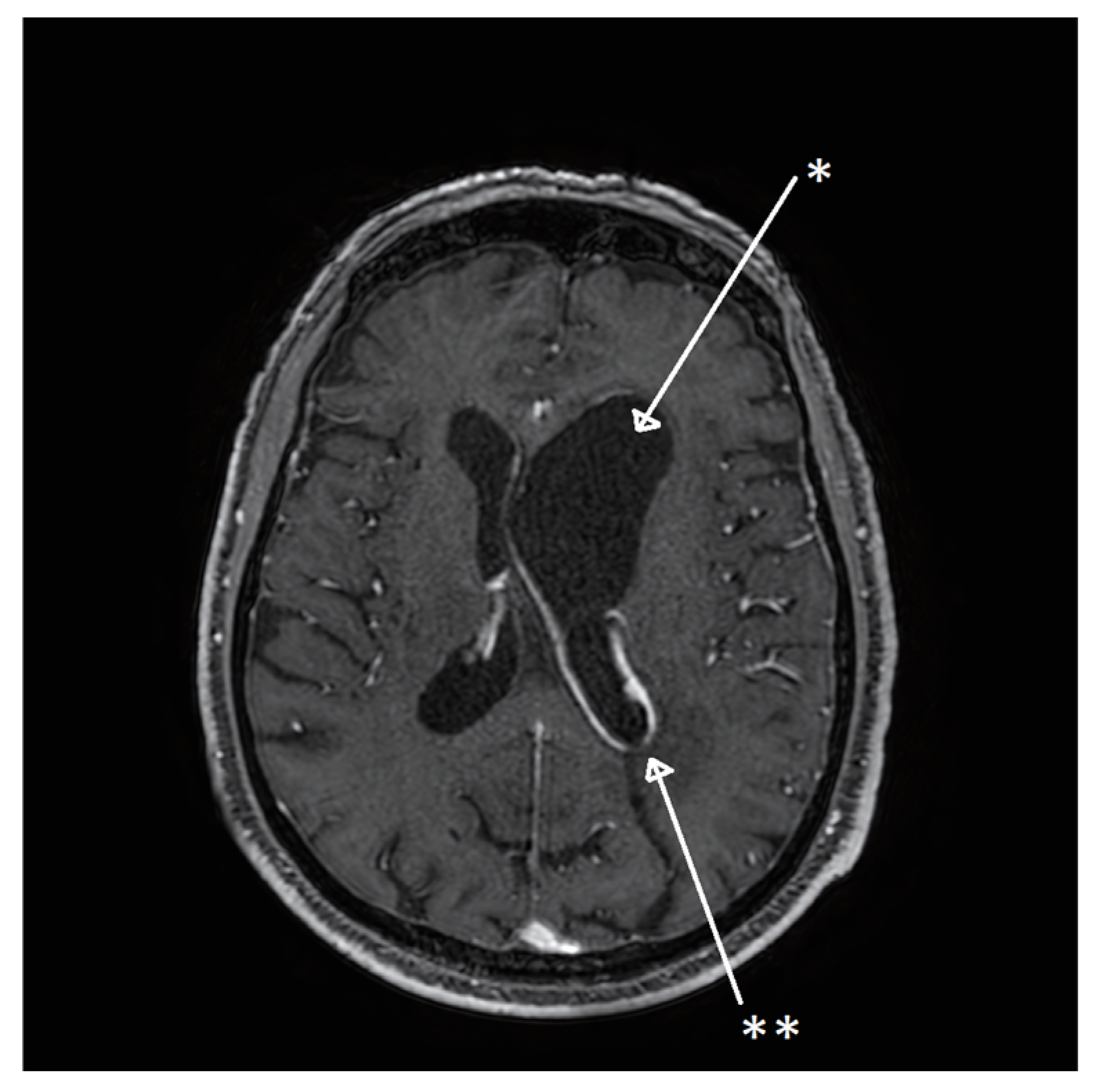 Microorganisms 13 01283 g002