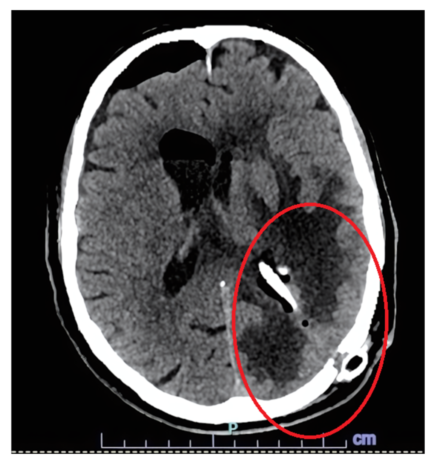 Microorganisms 13 01283 g004
