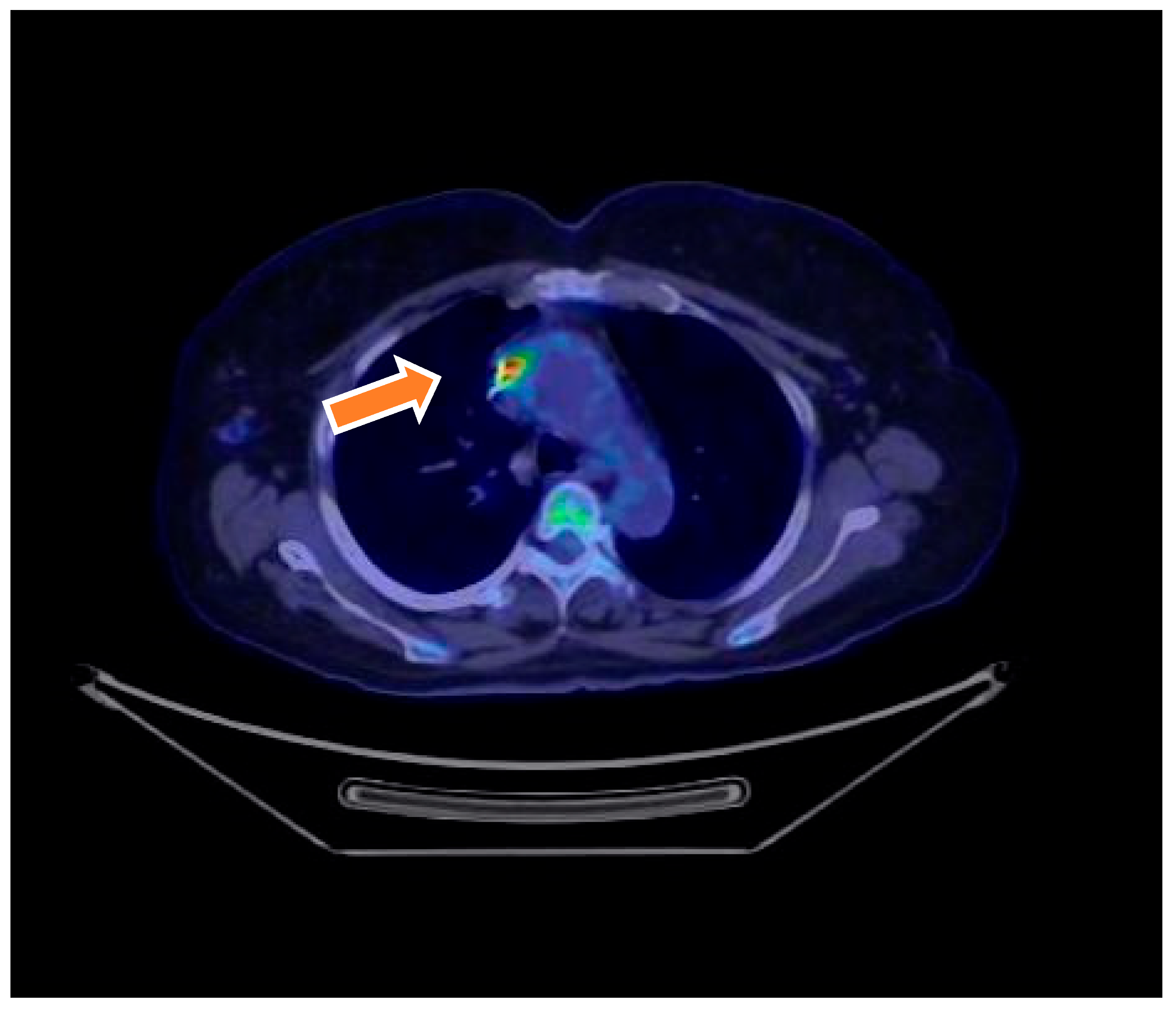 Microorganisms 13 01299 g001