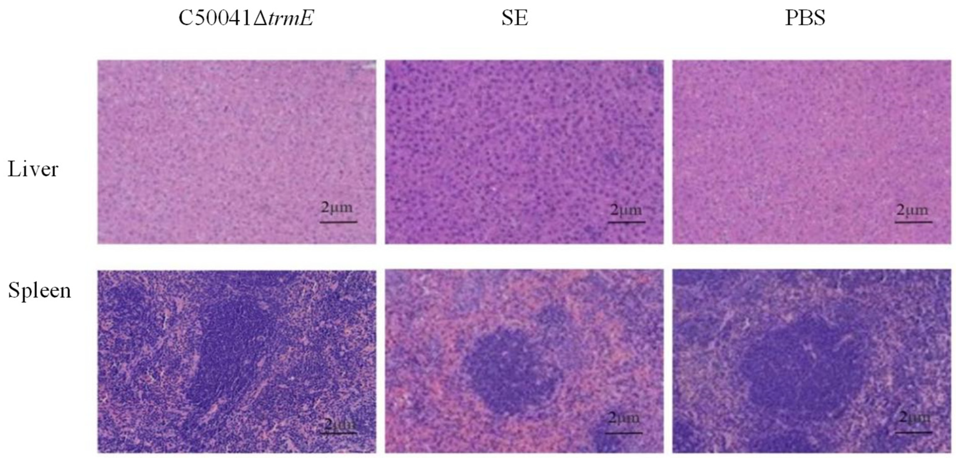 Microorganisms 13 01455 g011