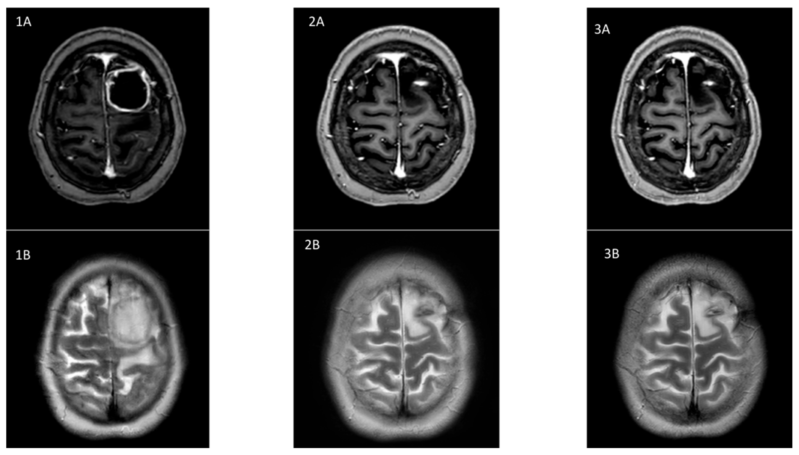 Microorganisms 13 01536 g001