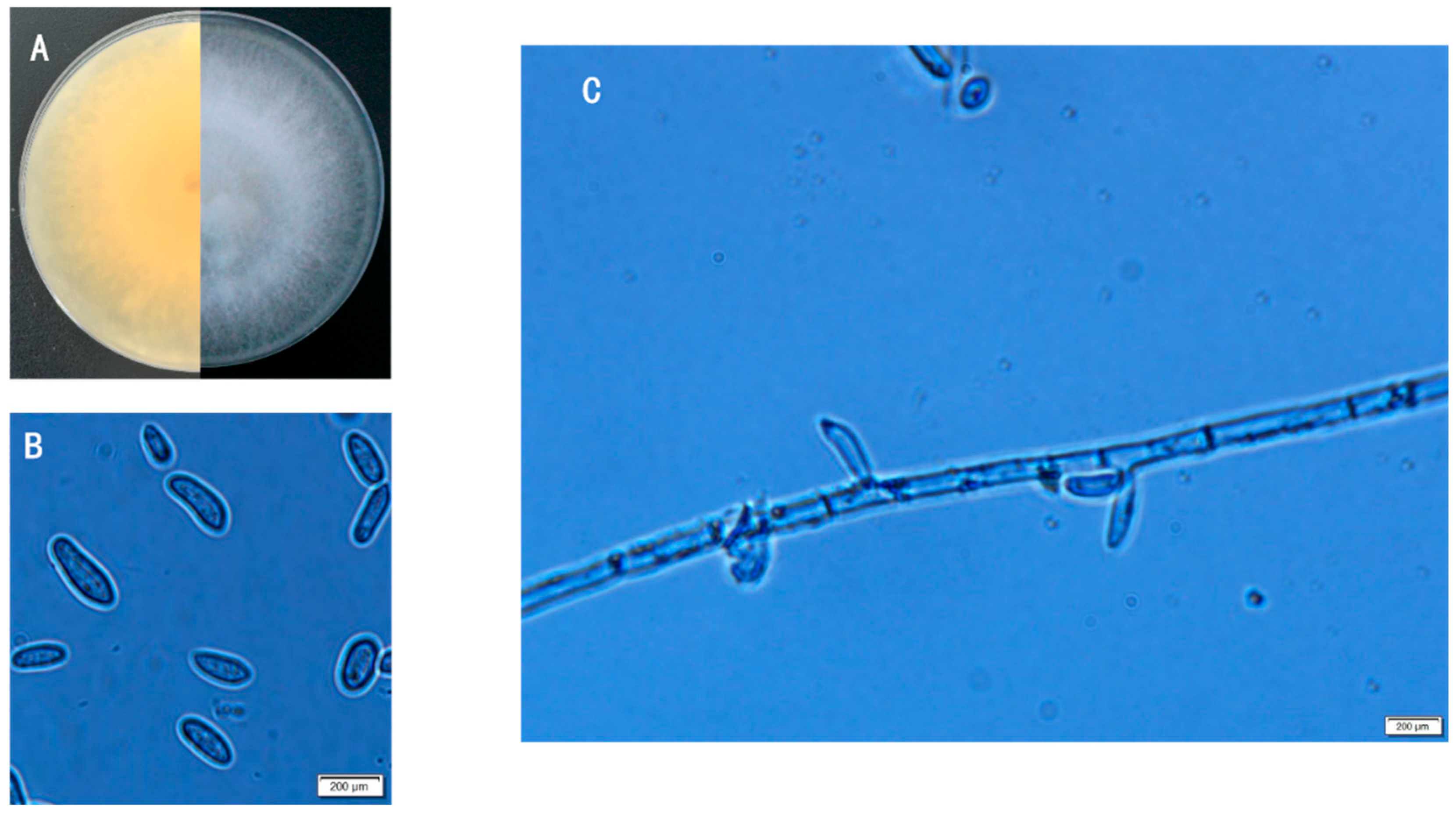 Microorganisms 13 01541 g004