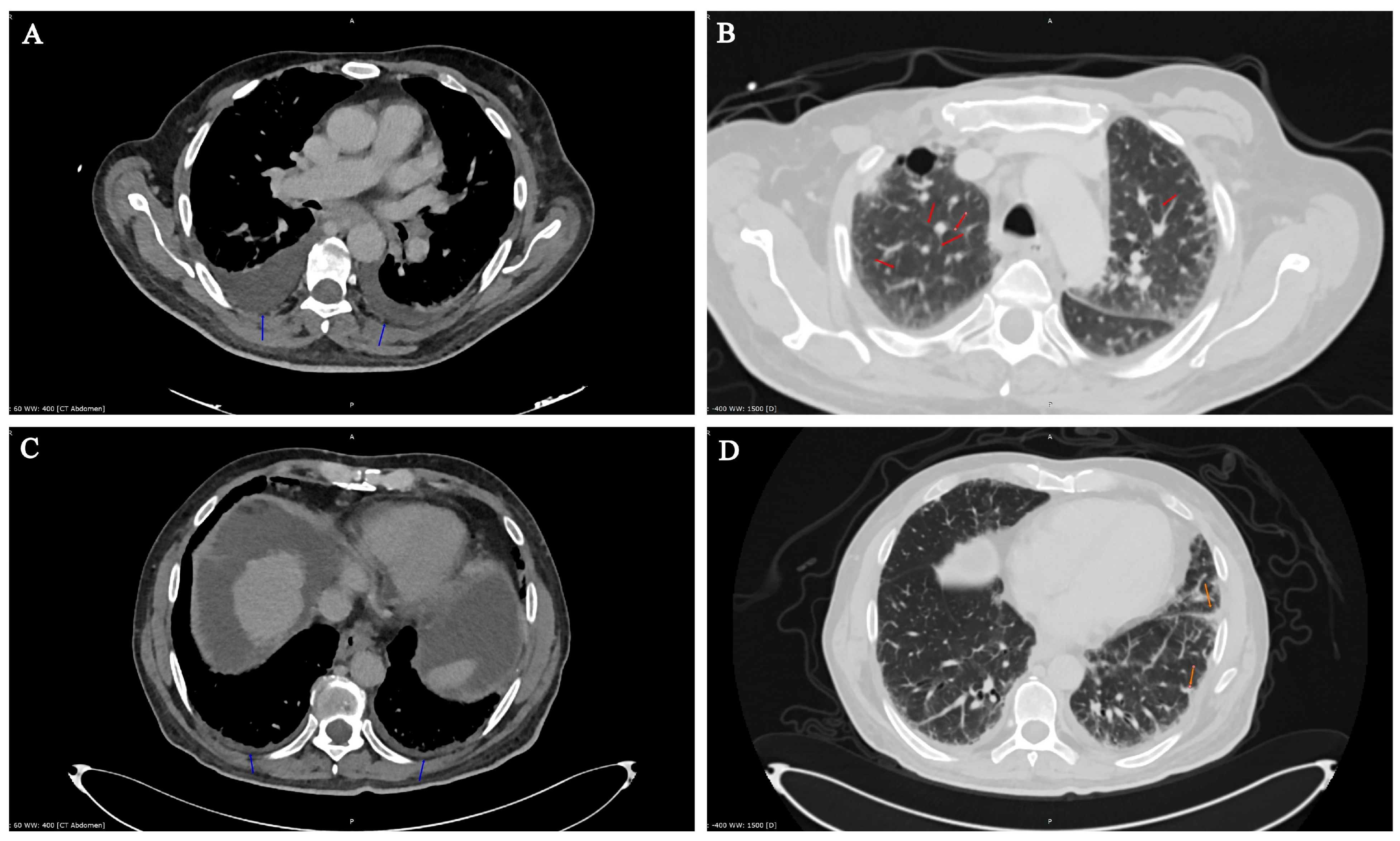 Microorganisms 13 01790 g001