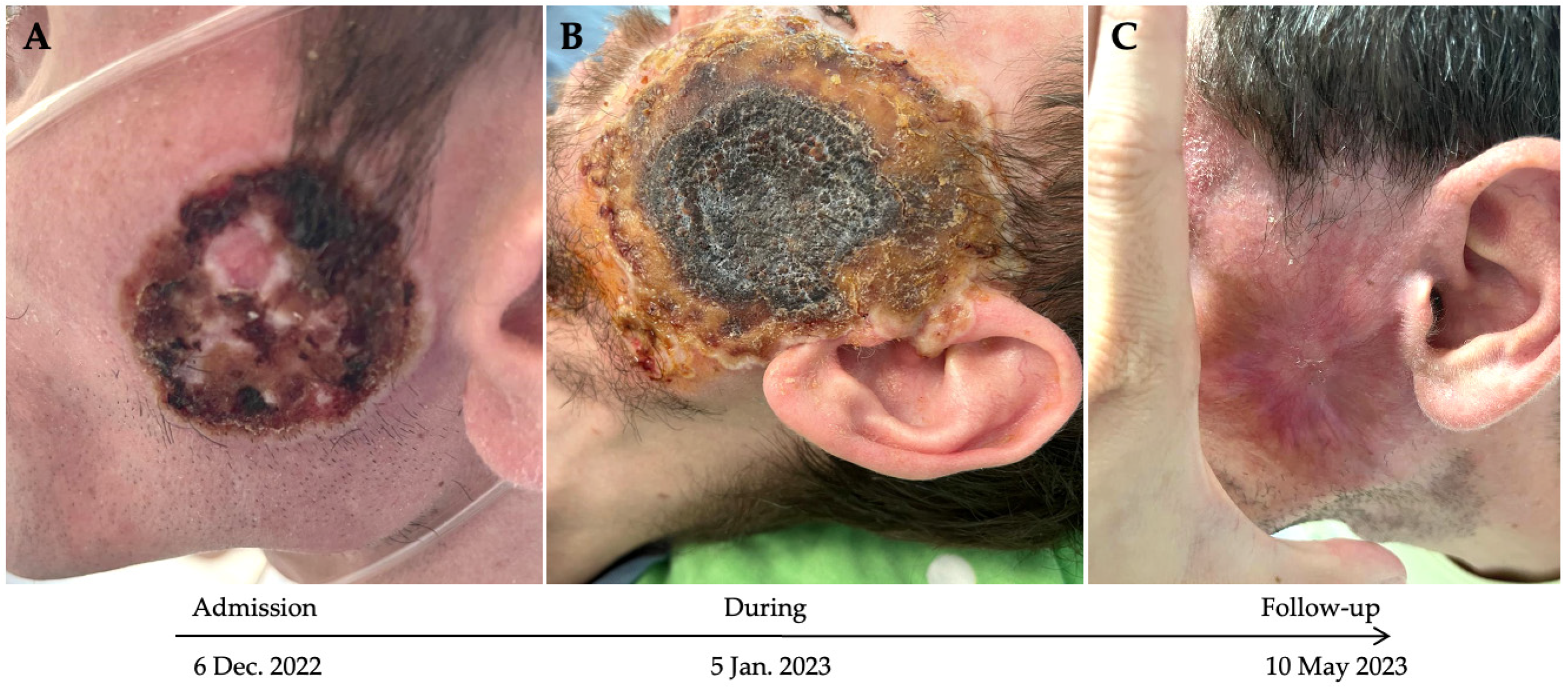 Microorganisms 13 01814 g001