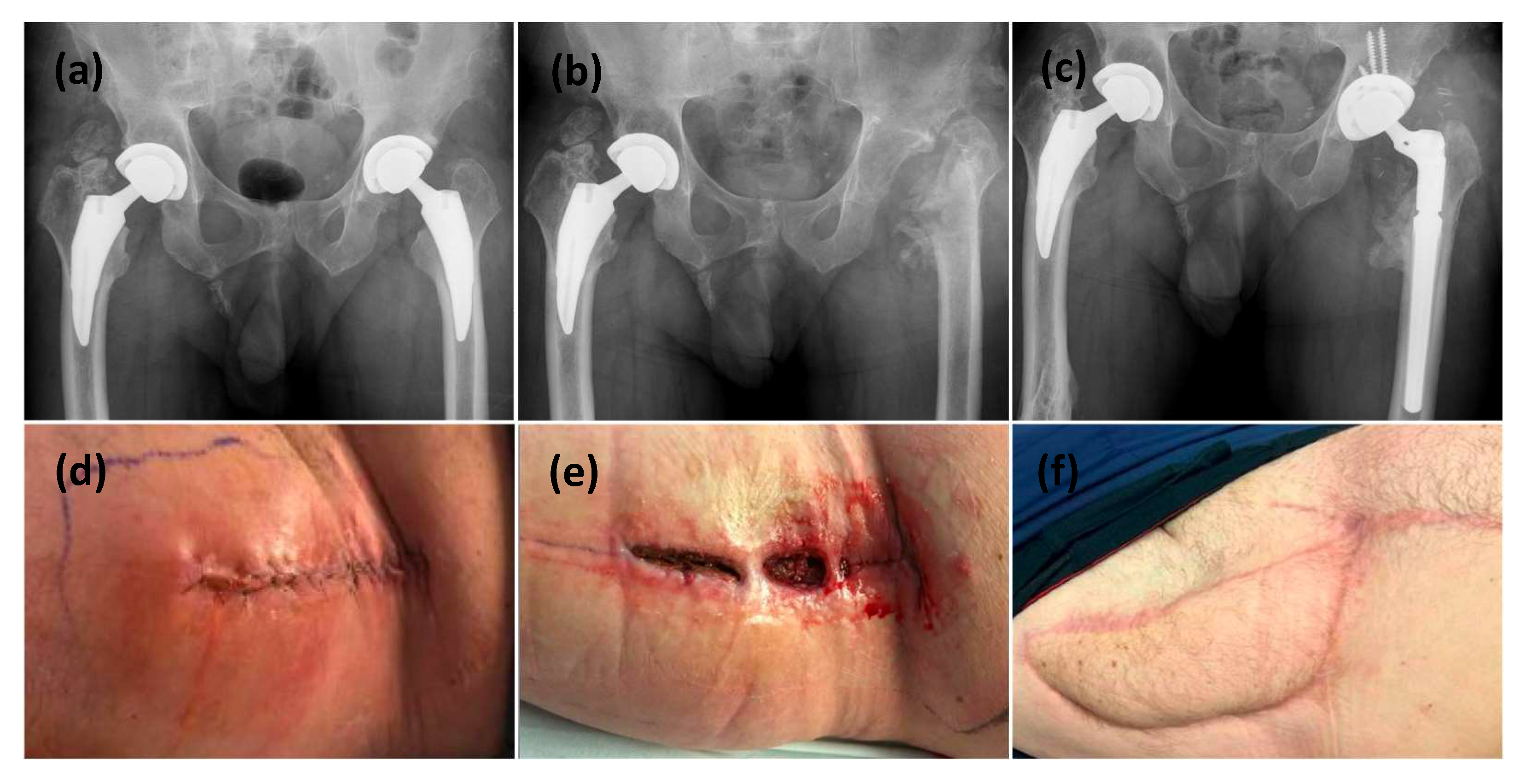 Microorganisms 13 01962 g001