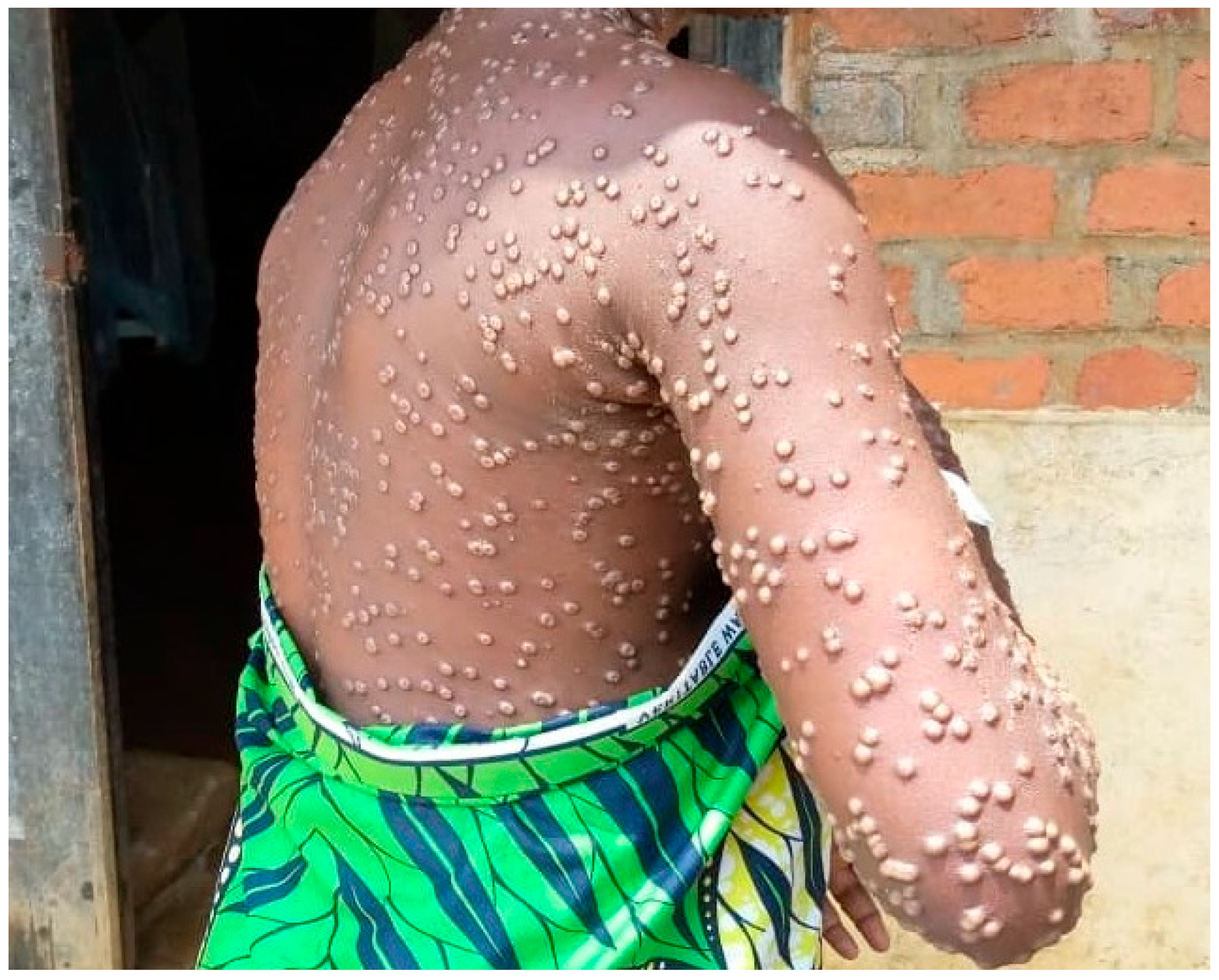 Microorganisms 13 02025 g001