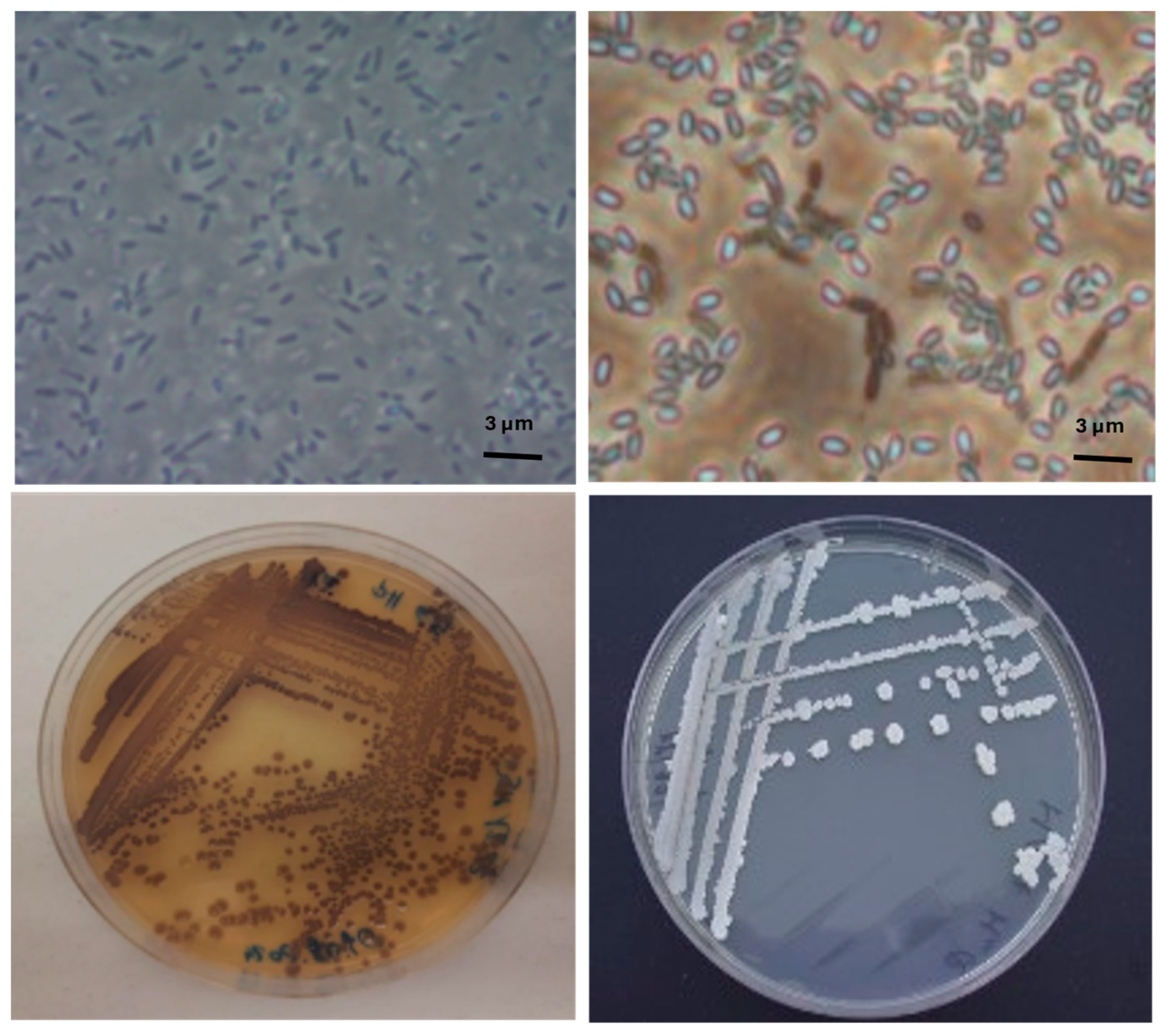 Microorganisms 13 02125 g002 Microorganisms 13 02125 g002