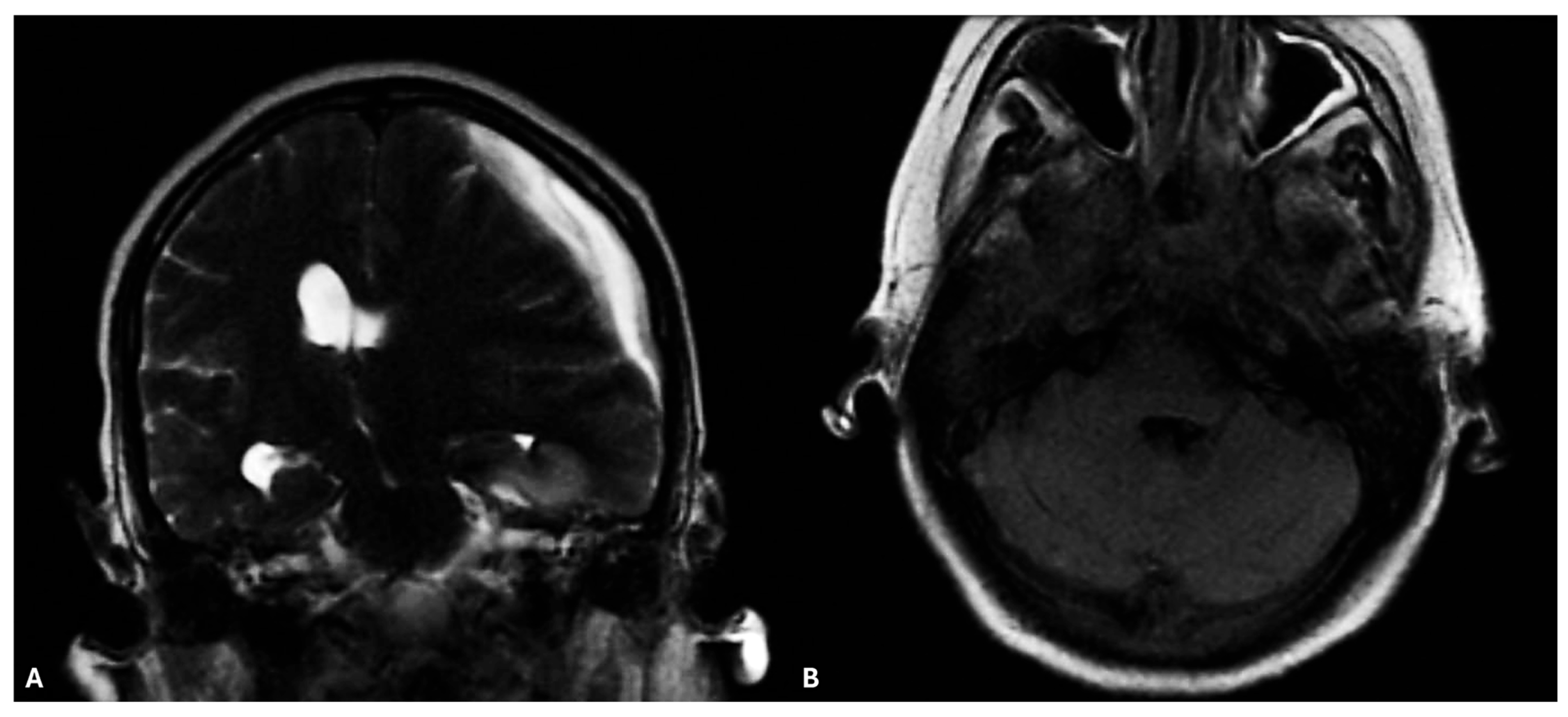 Microorganisms 13 02135 g001 Microorganisms 13 02135 g001
