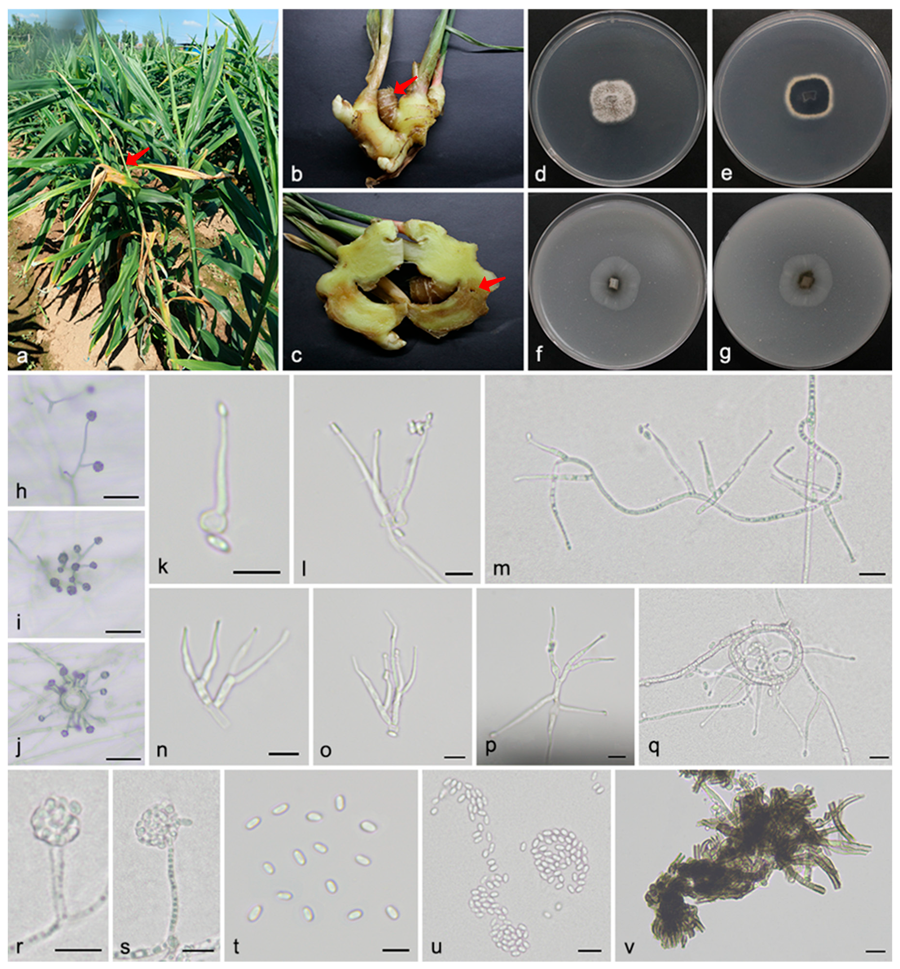 Microorganisms 13 02180 g004