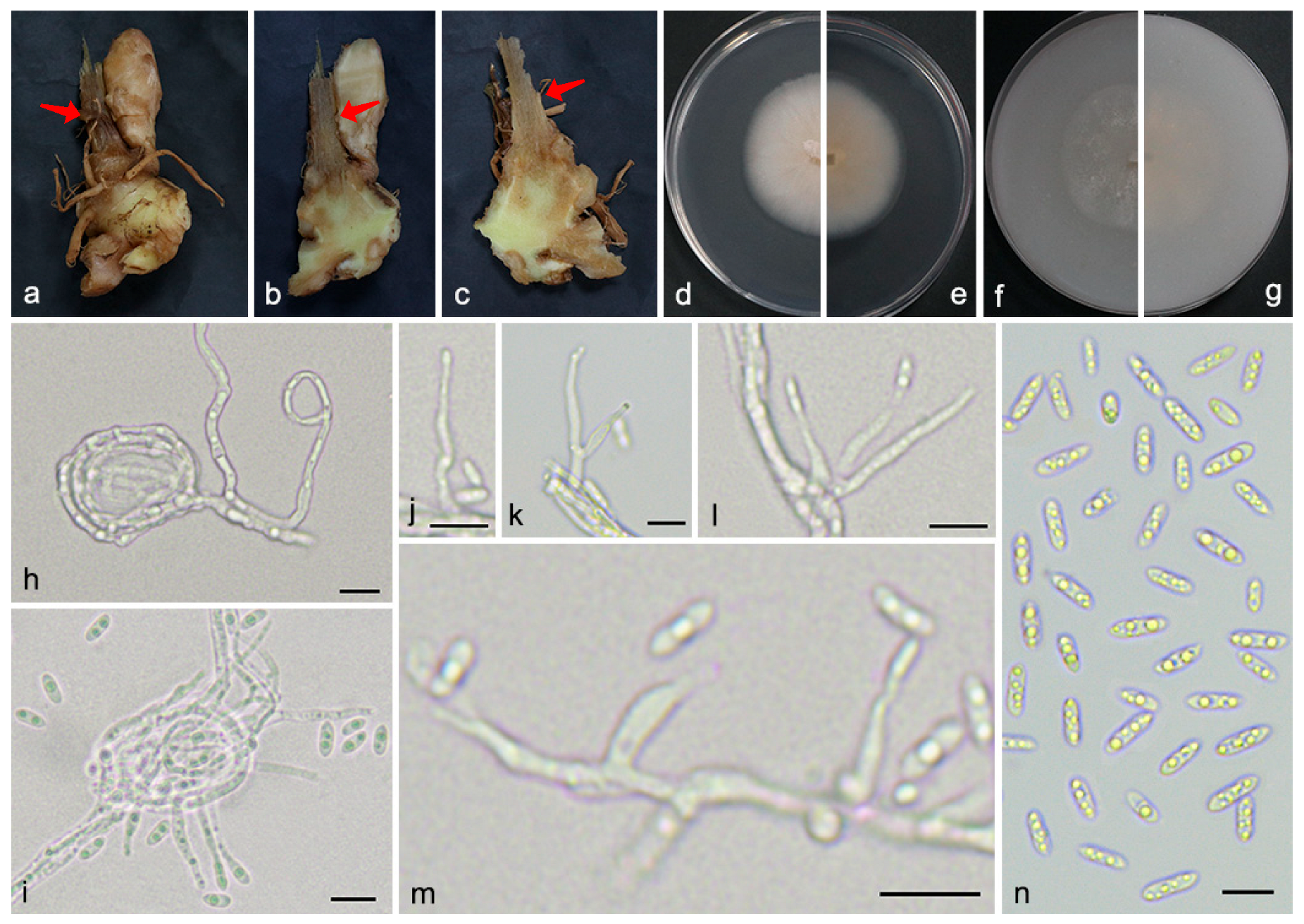 Microorganisms 13 02180 g005