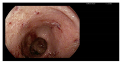 Microorganisms 13 02209 i005 Microorganisms 13 02209 i005