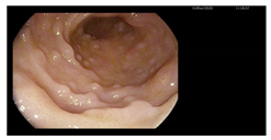 Microorganisms 13 02209 i006 Microorganisms 13 02209 i006