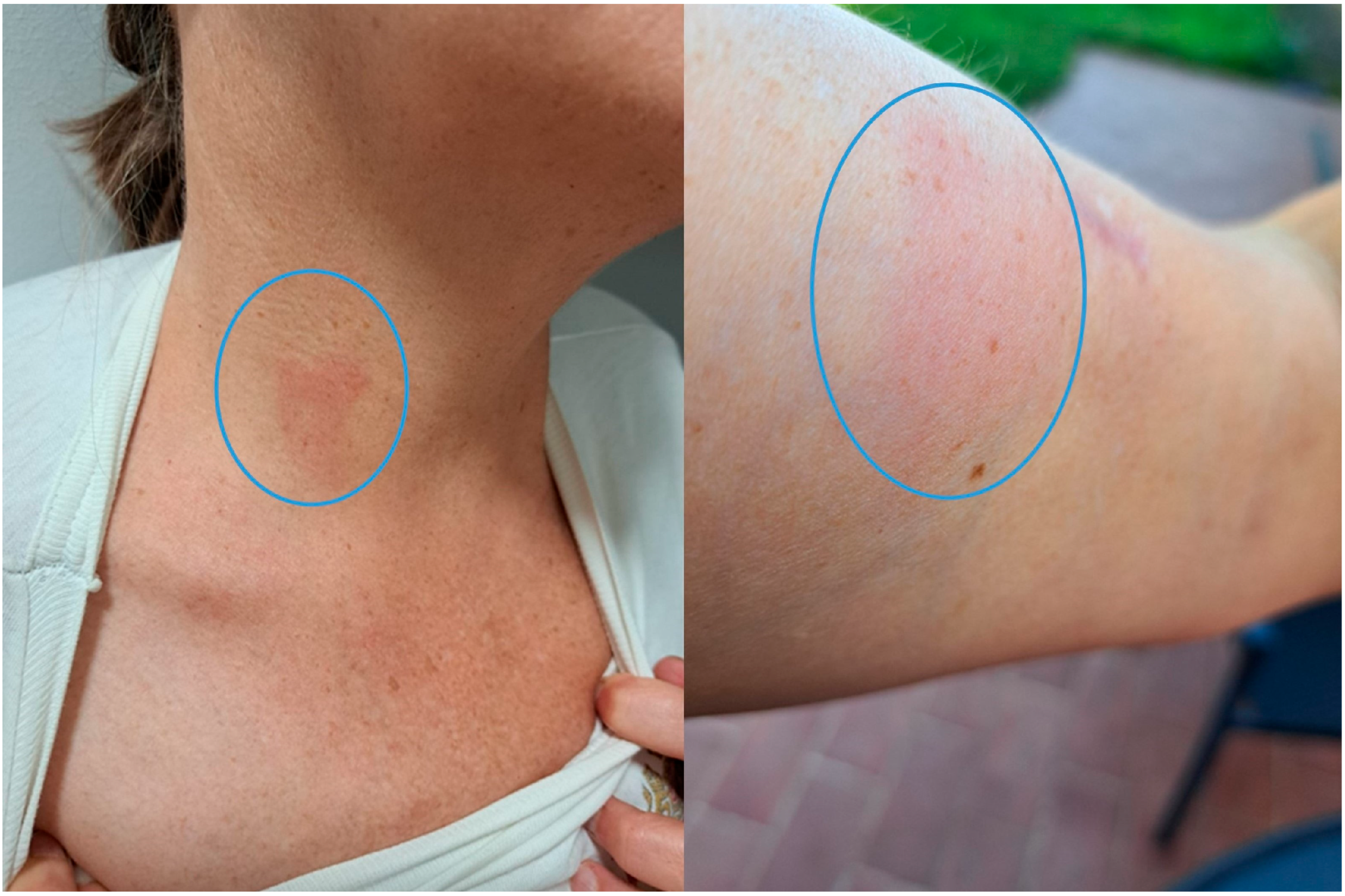 Microorganisms 13 02263 g001