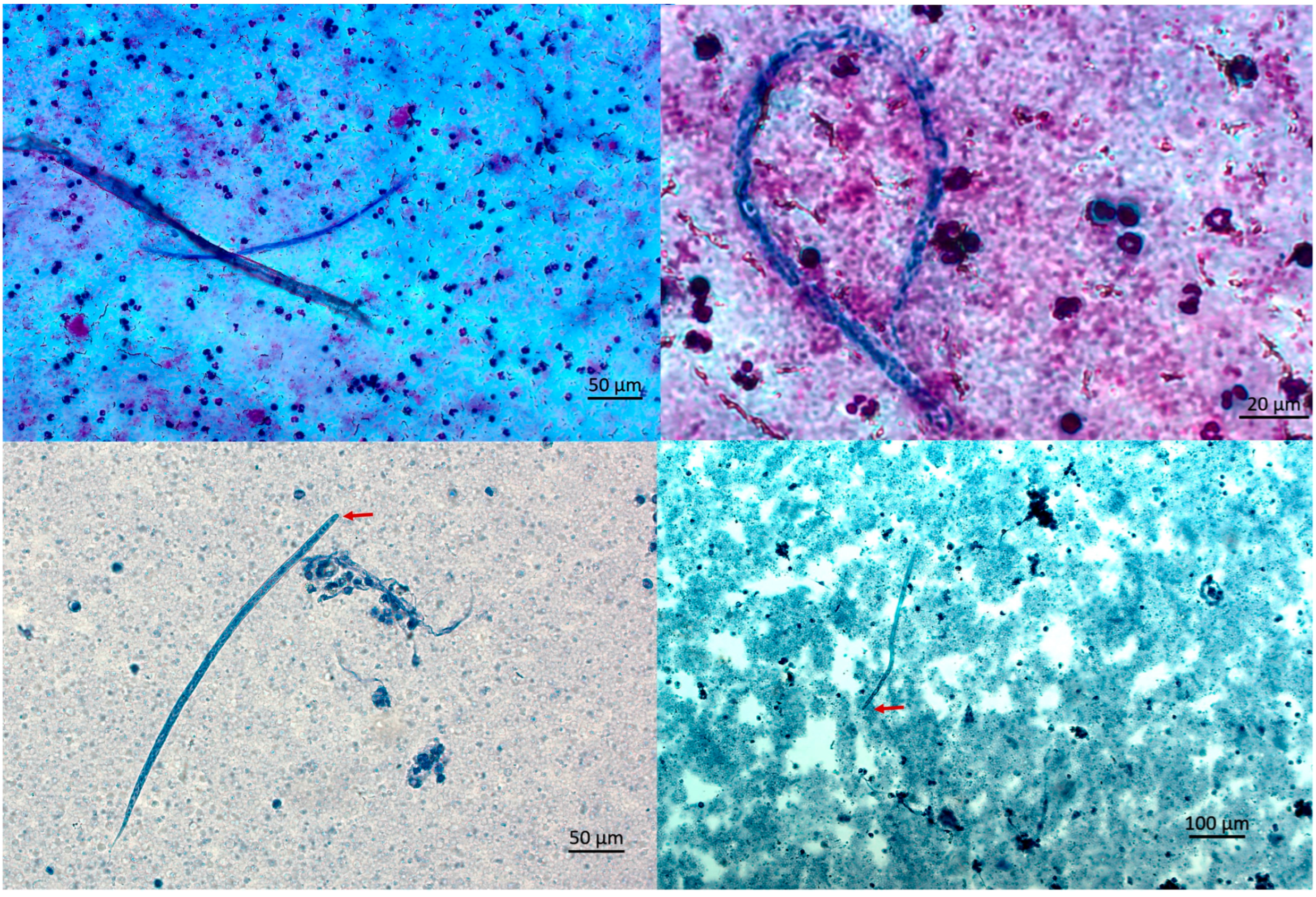 Microorganisms 13 02263 g002