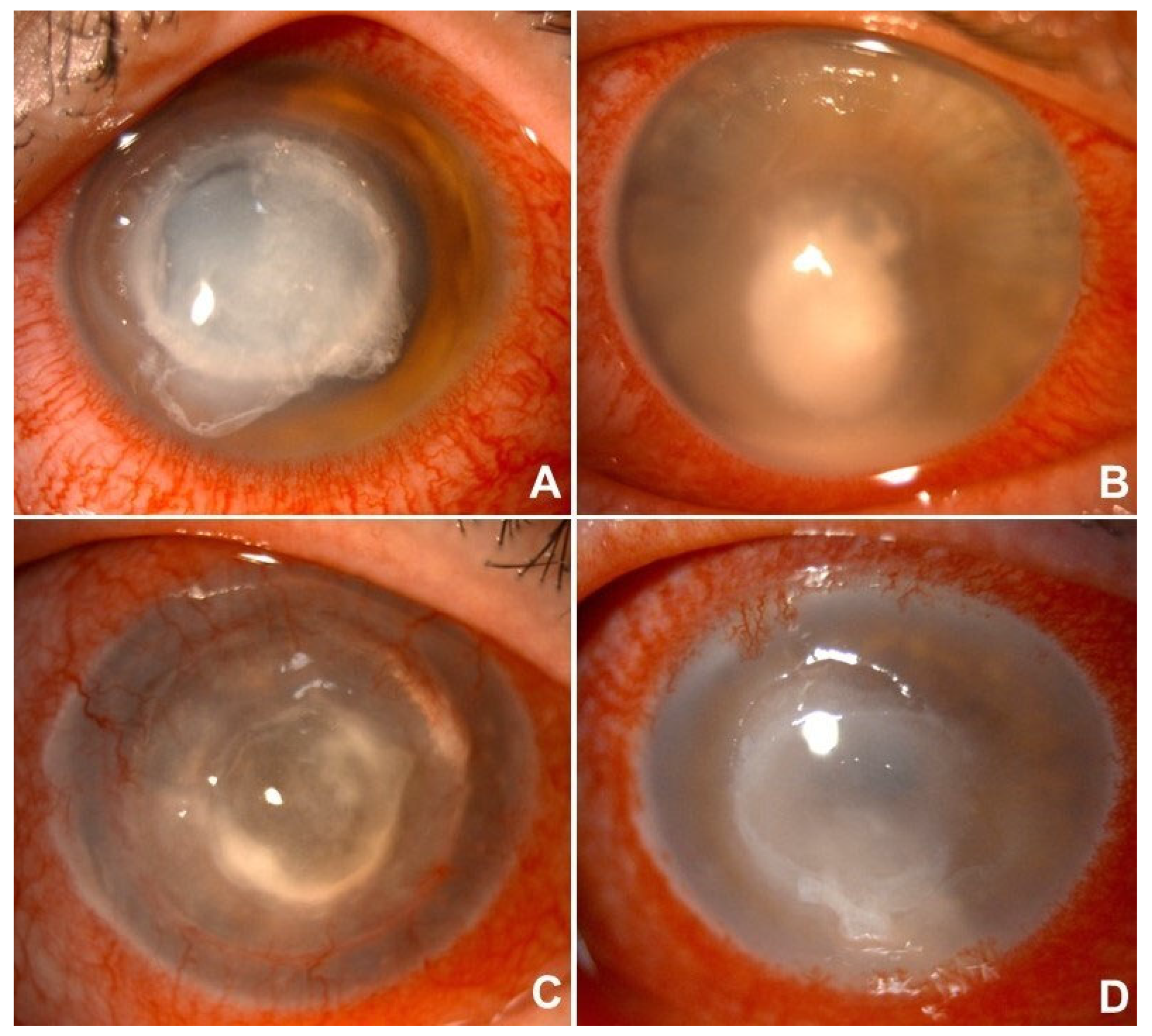 Microorganisms 13 02308 g001