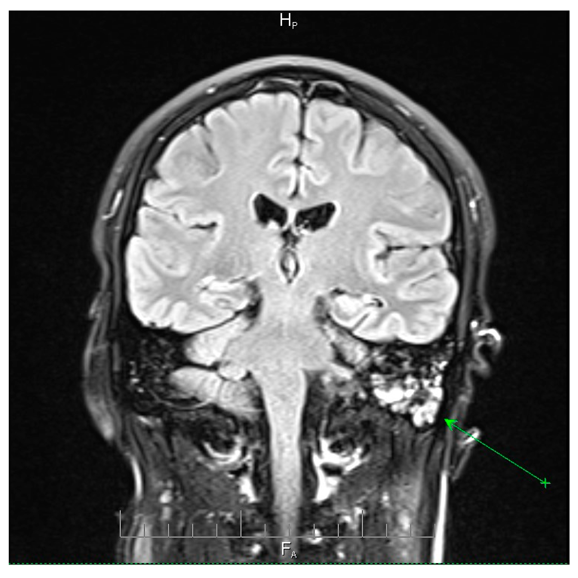 Microorganisms 13 02315 g001