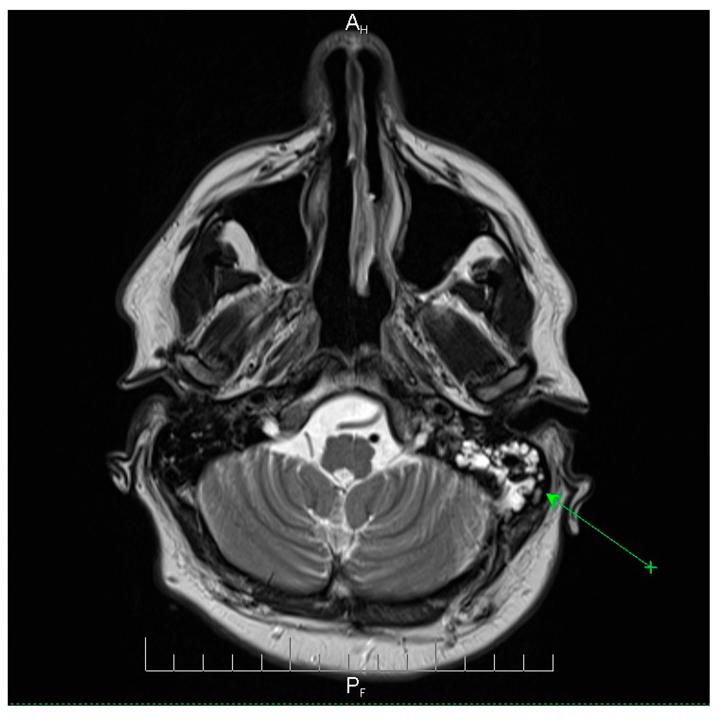 Microorganisms 13 02315 g002
