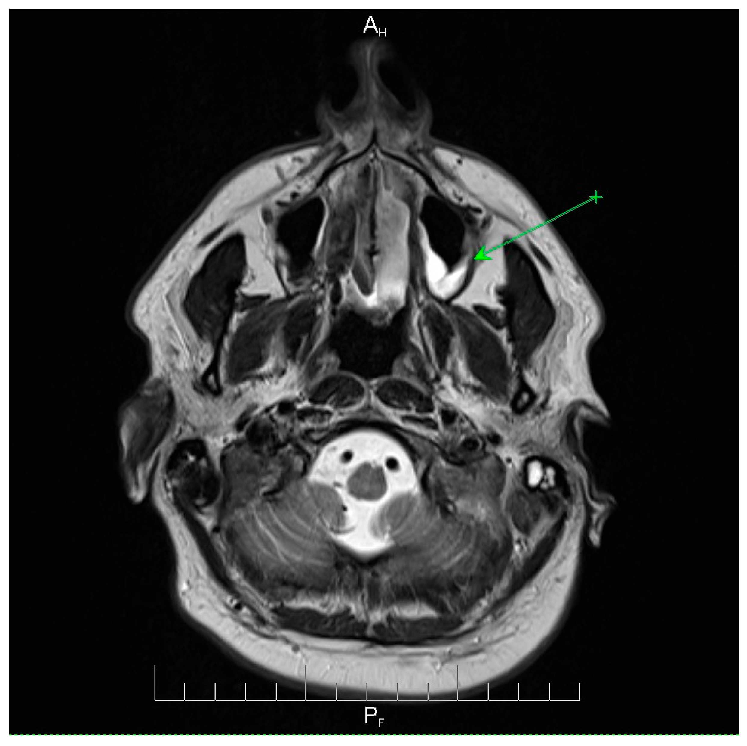 Microorganisms 13 02315 g003