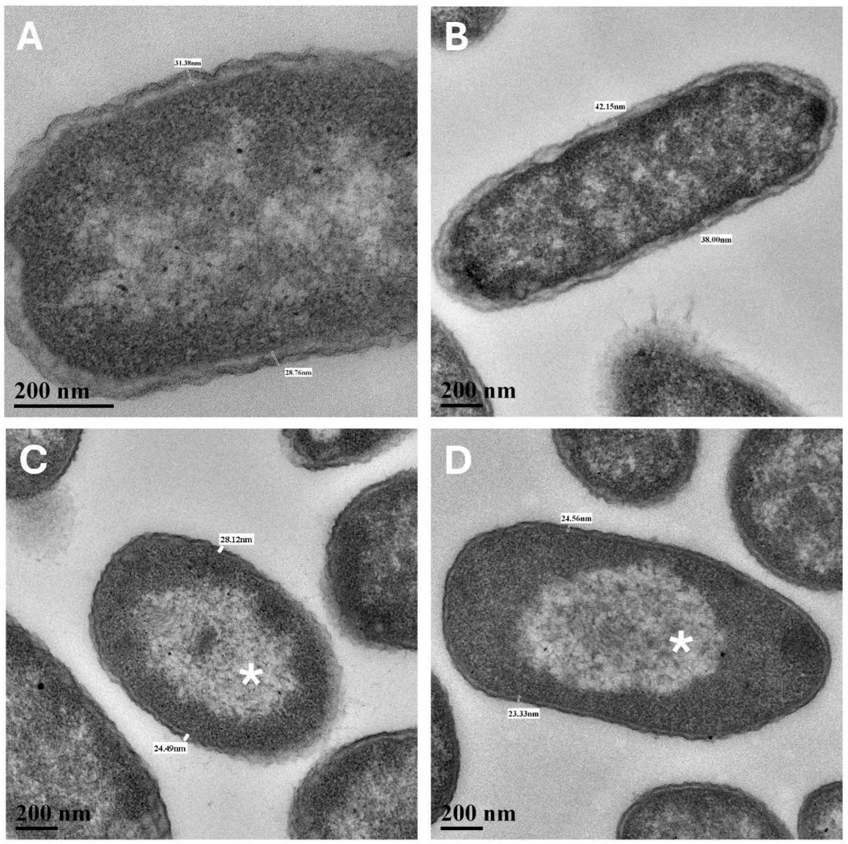 Microorganisms 13 02466 g004