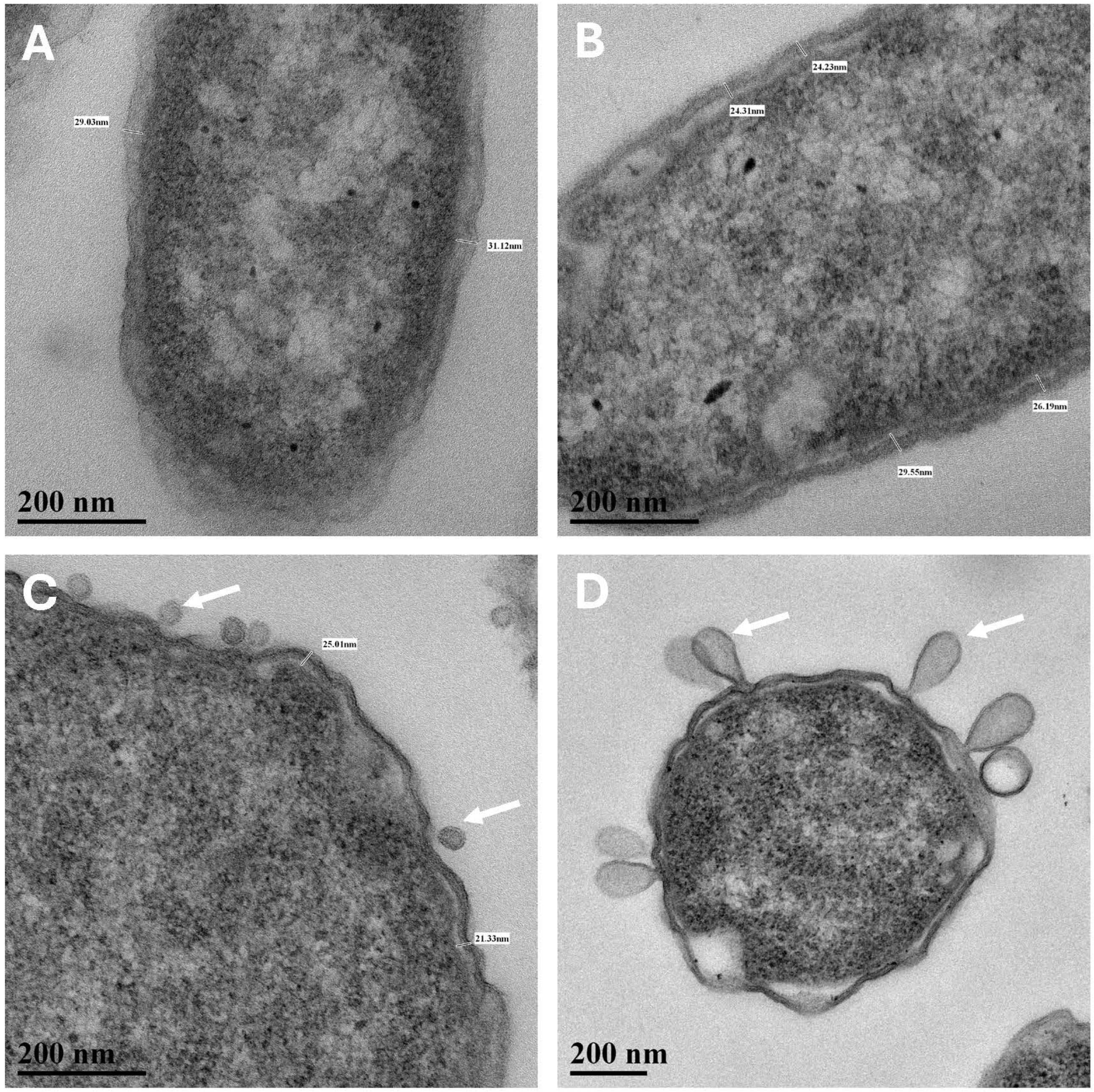 Microorganisms 13 02466 g005