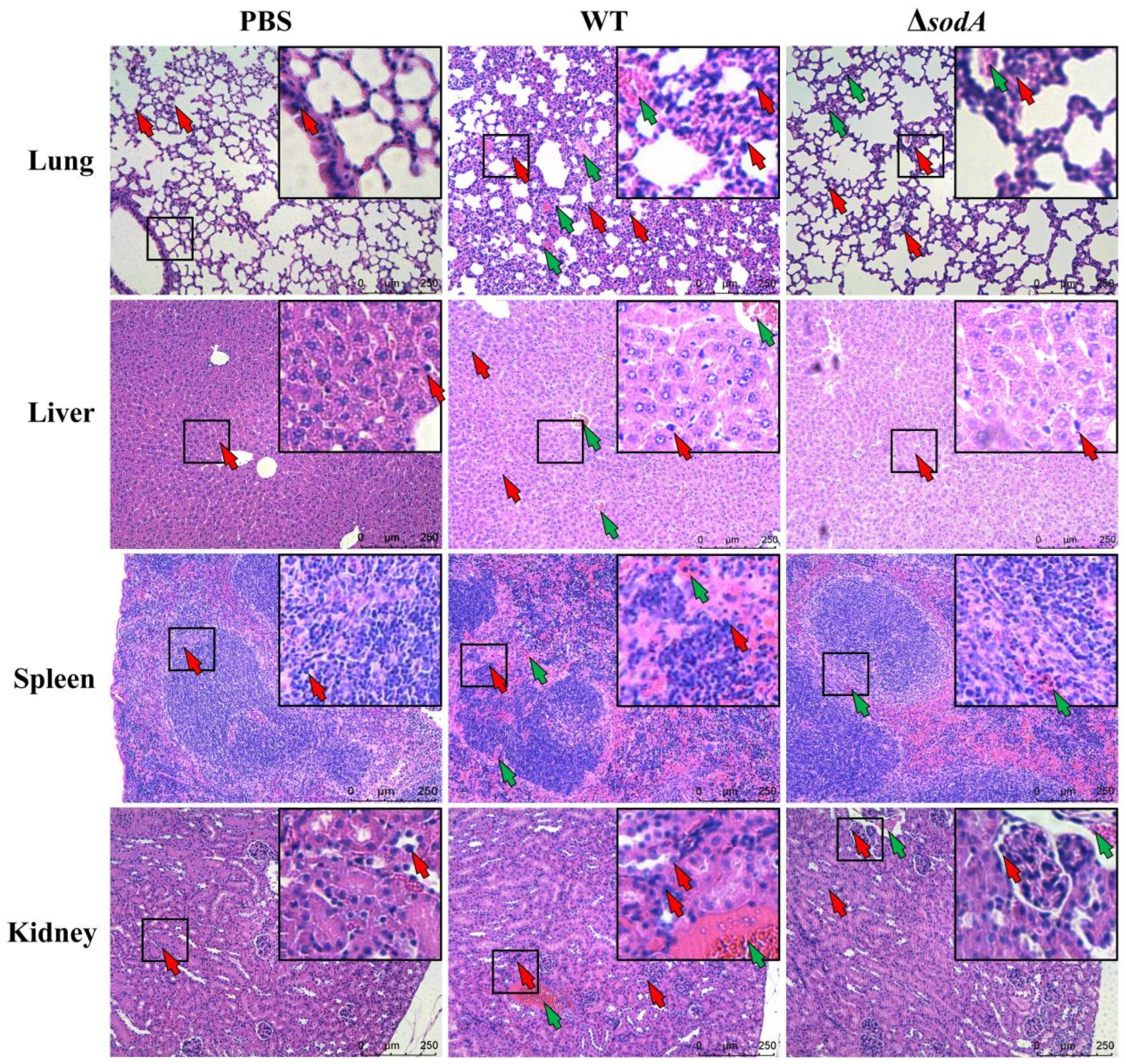 Microorganisms 13 02566 g002