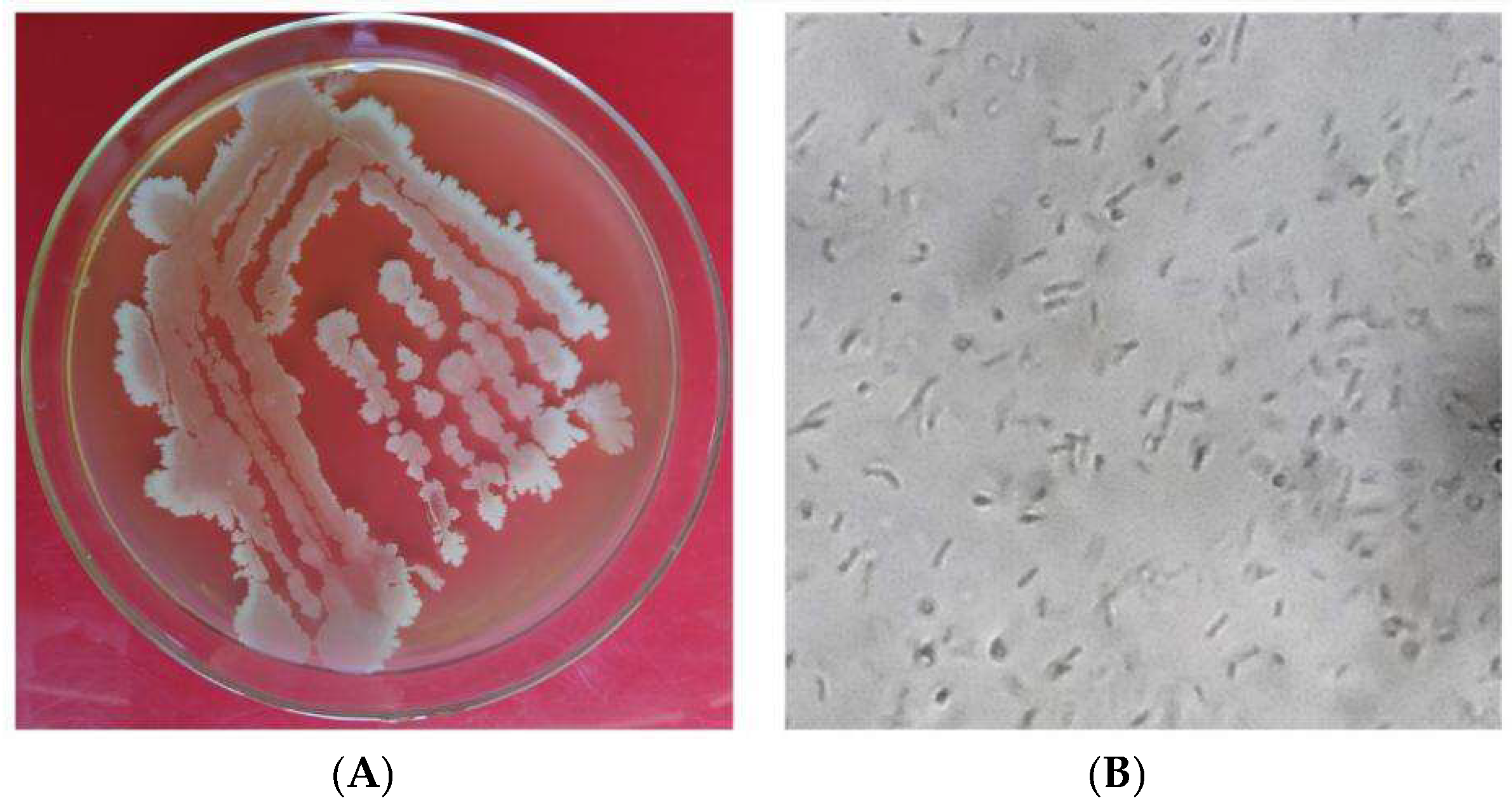 Microorganisms 13 02640 g003