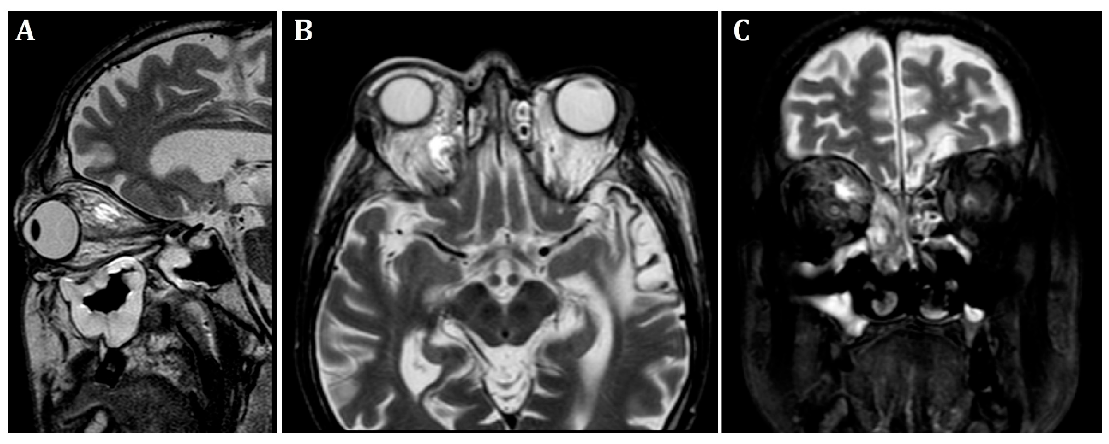Microorganisms 13 02695 g001