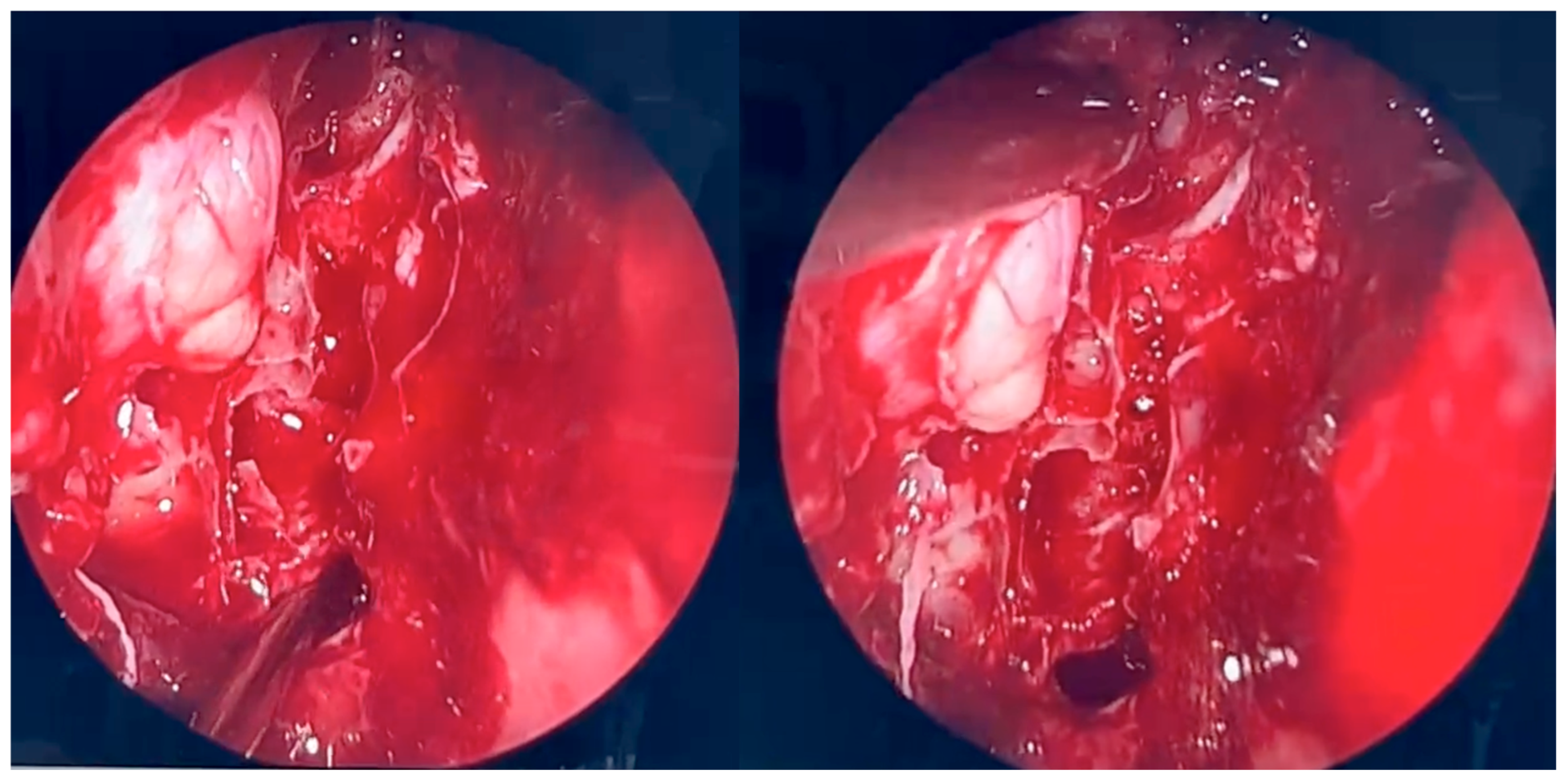 Microorganisms 13 02695 g004