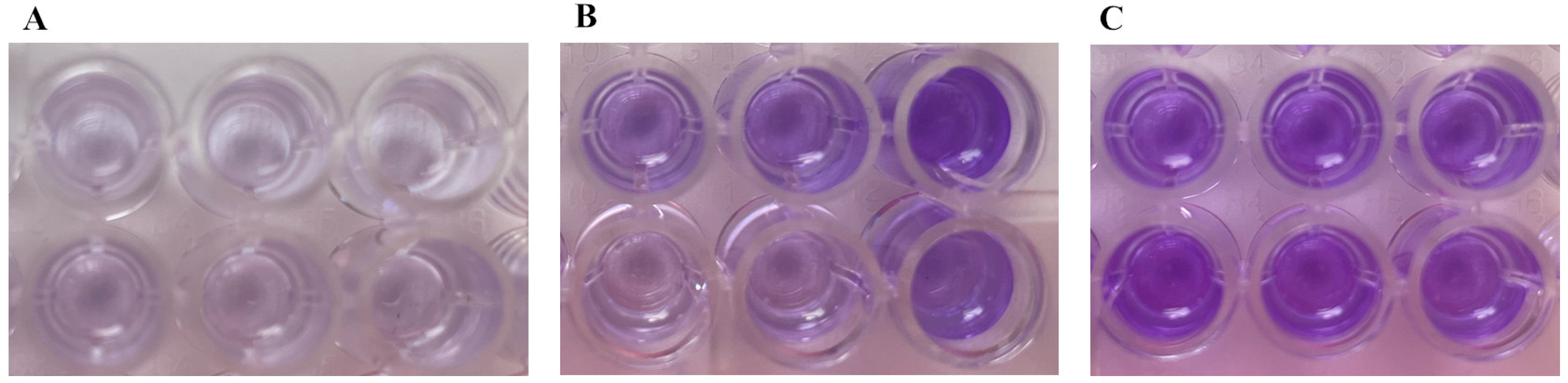 Microorganisms 13 02699 g003