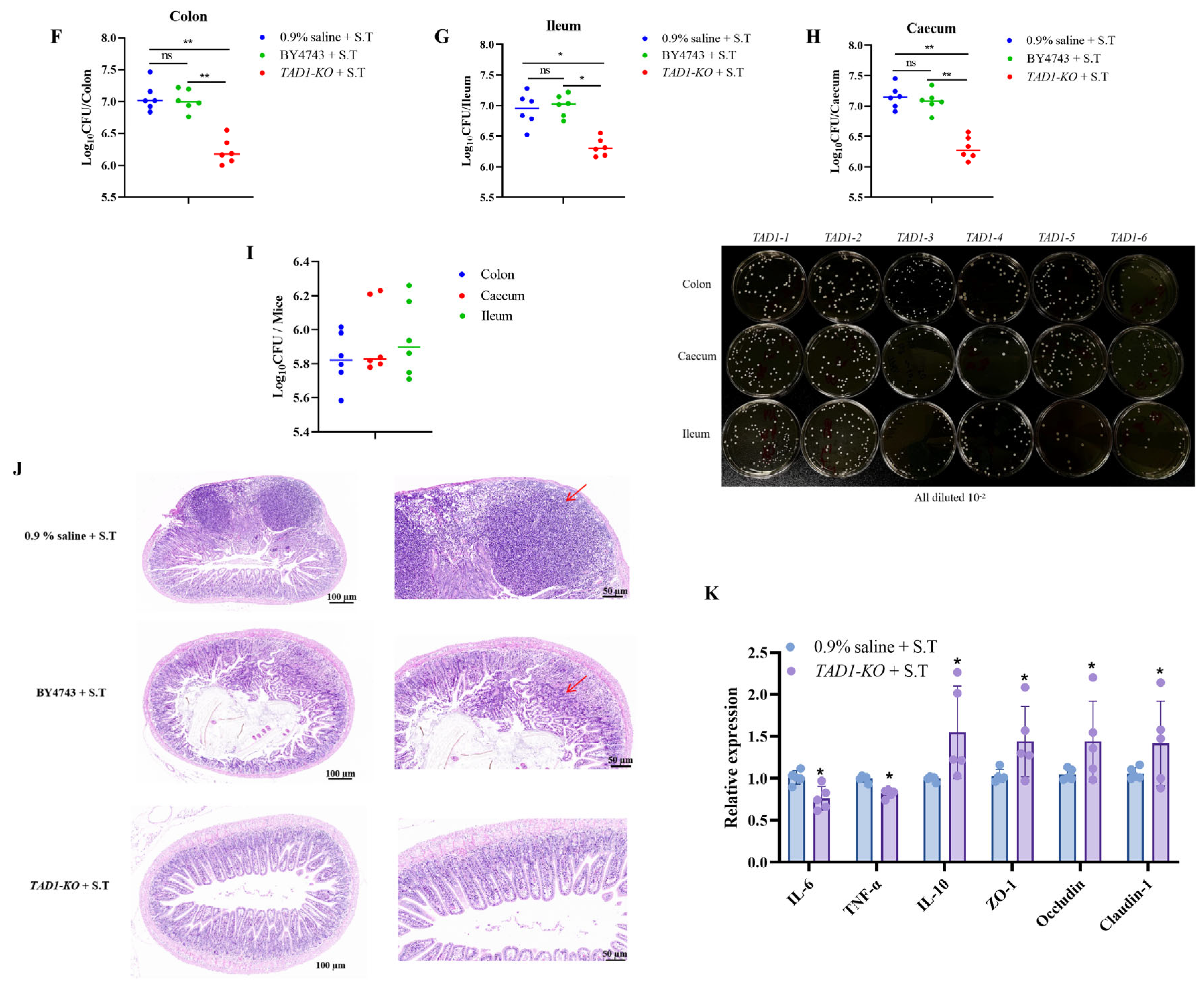 Microorganisms 13 02848 g010b