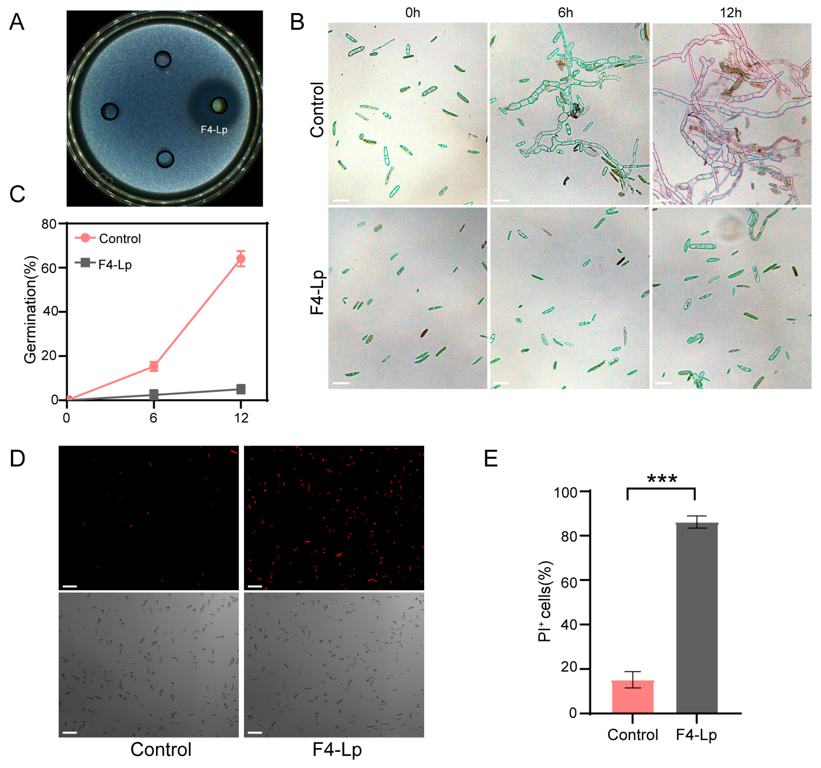 Microorganisms 14 00047 g006