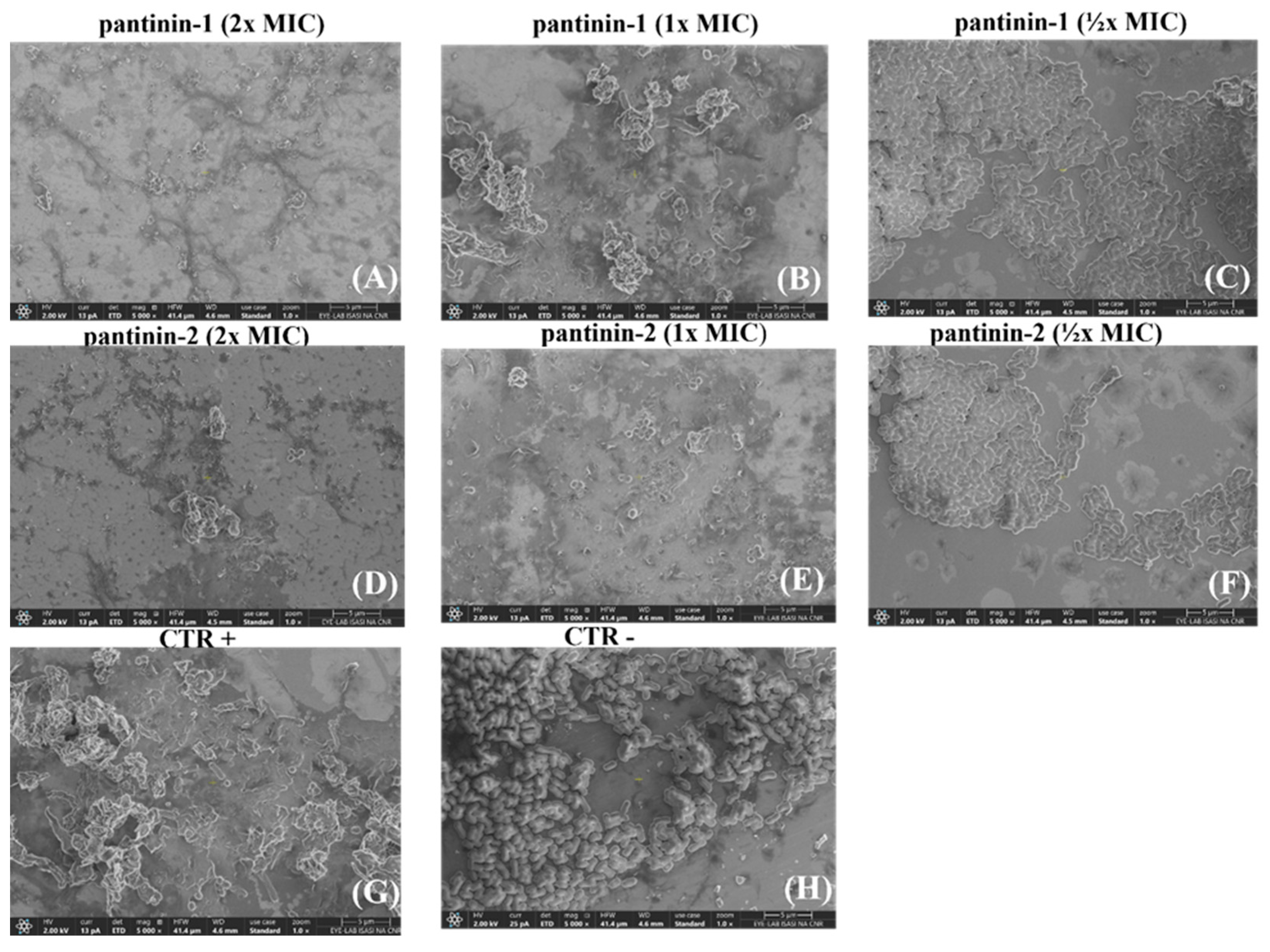 Microorganisms 14 00068 g005