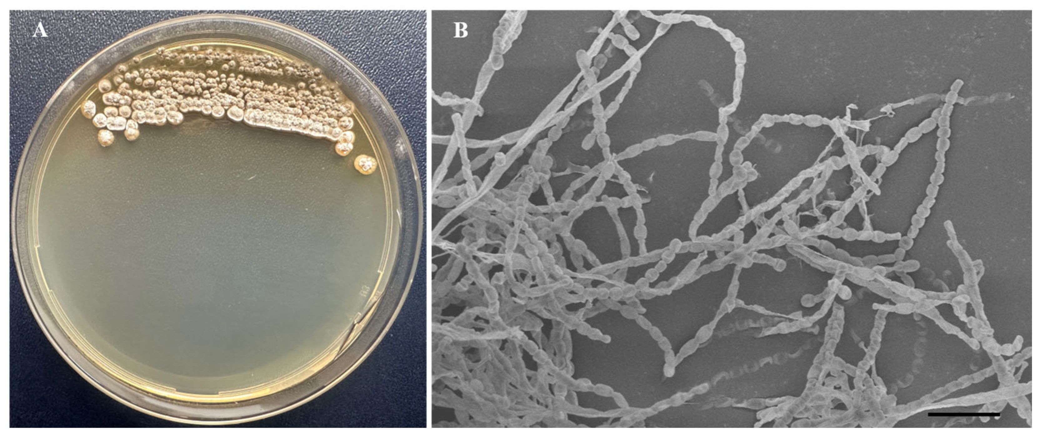 Microorganisms 14 00818 g004