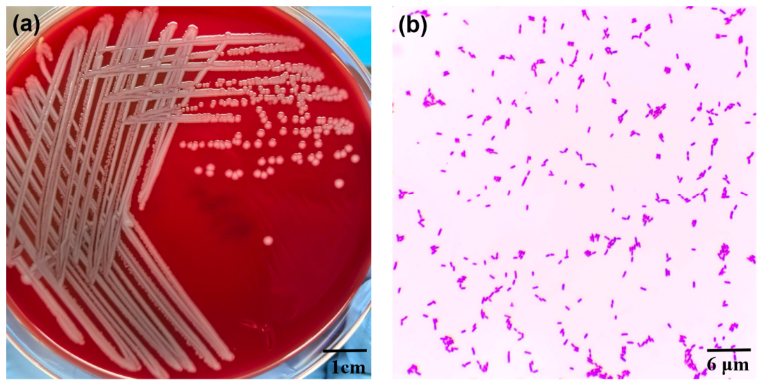 Microorganisms 14 01996 g001 Microorganisms 14 01996 g001