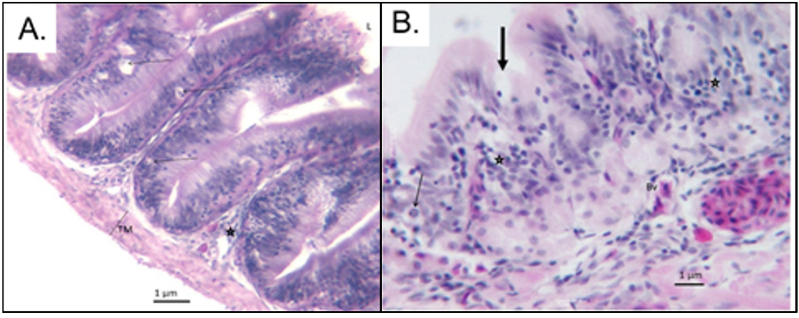 Microplastics 01 00017 g004
