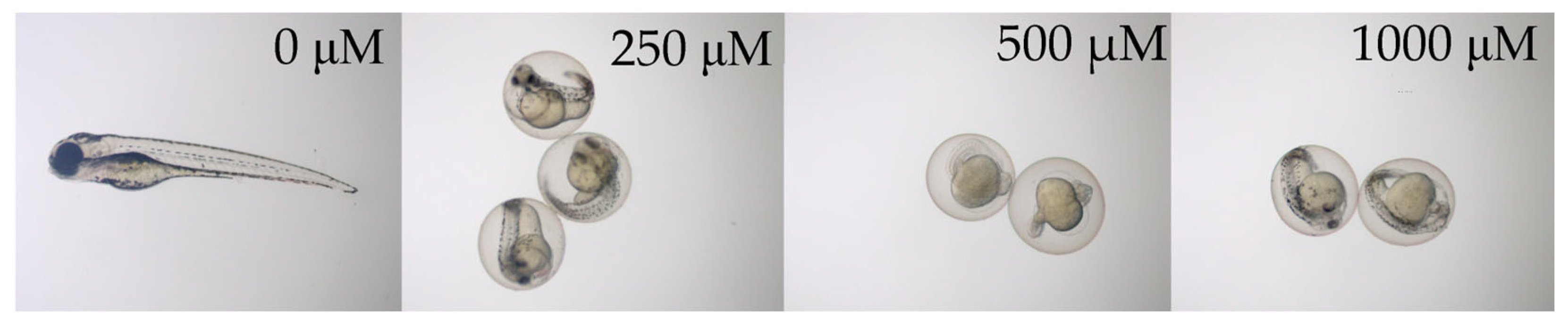 Microplastics 04 00045 g001