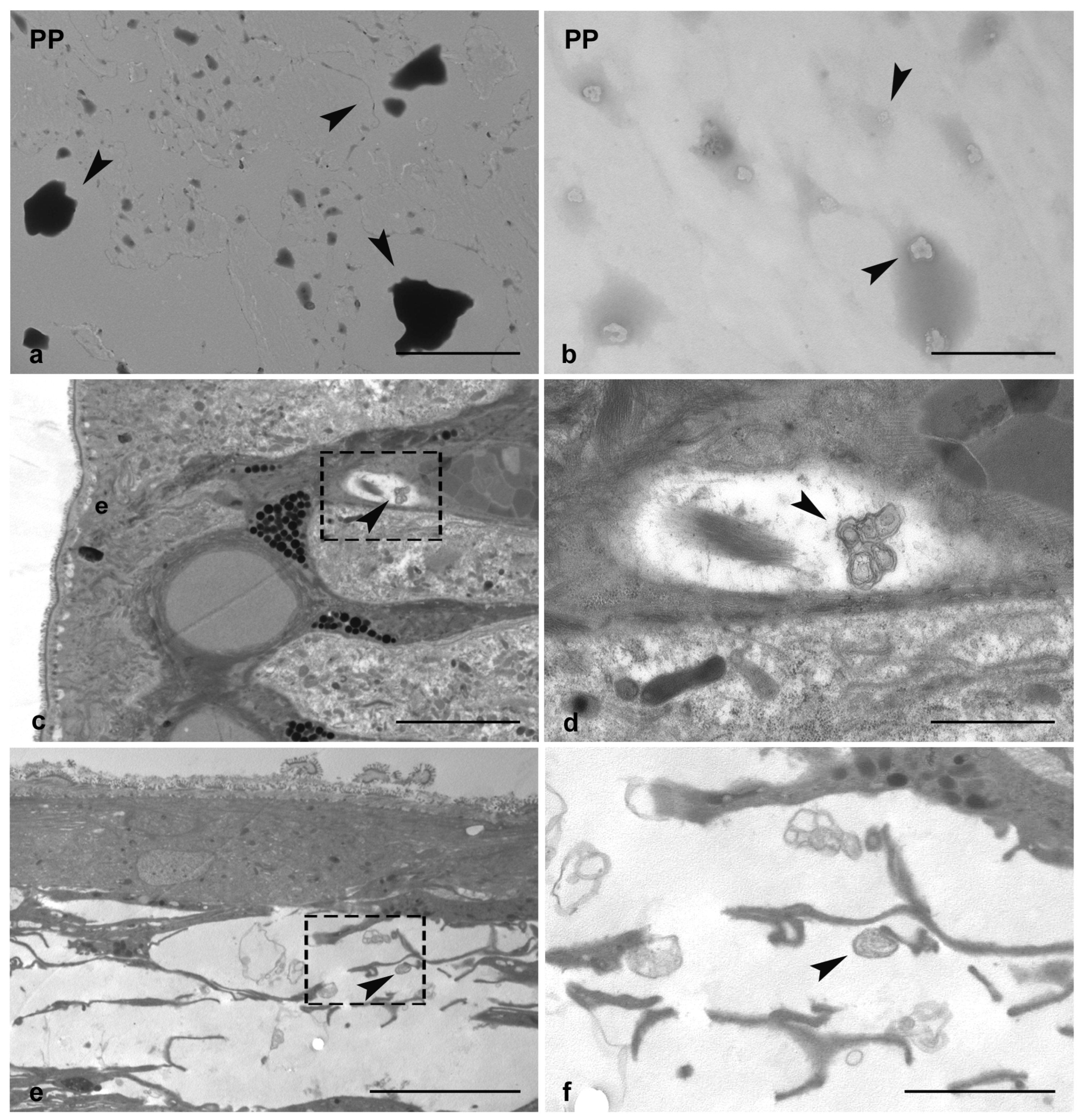 Microplastics 04 00056 g001 Microplastics 04 00056 g001