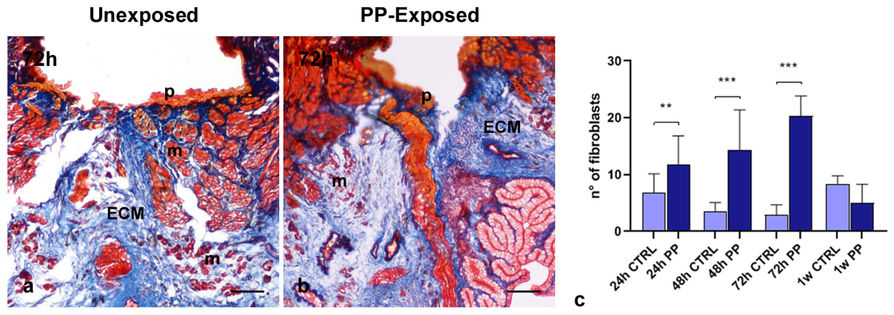 Microplastics 04 00056 g004 Microplastics 04 00056 g004